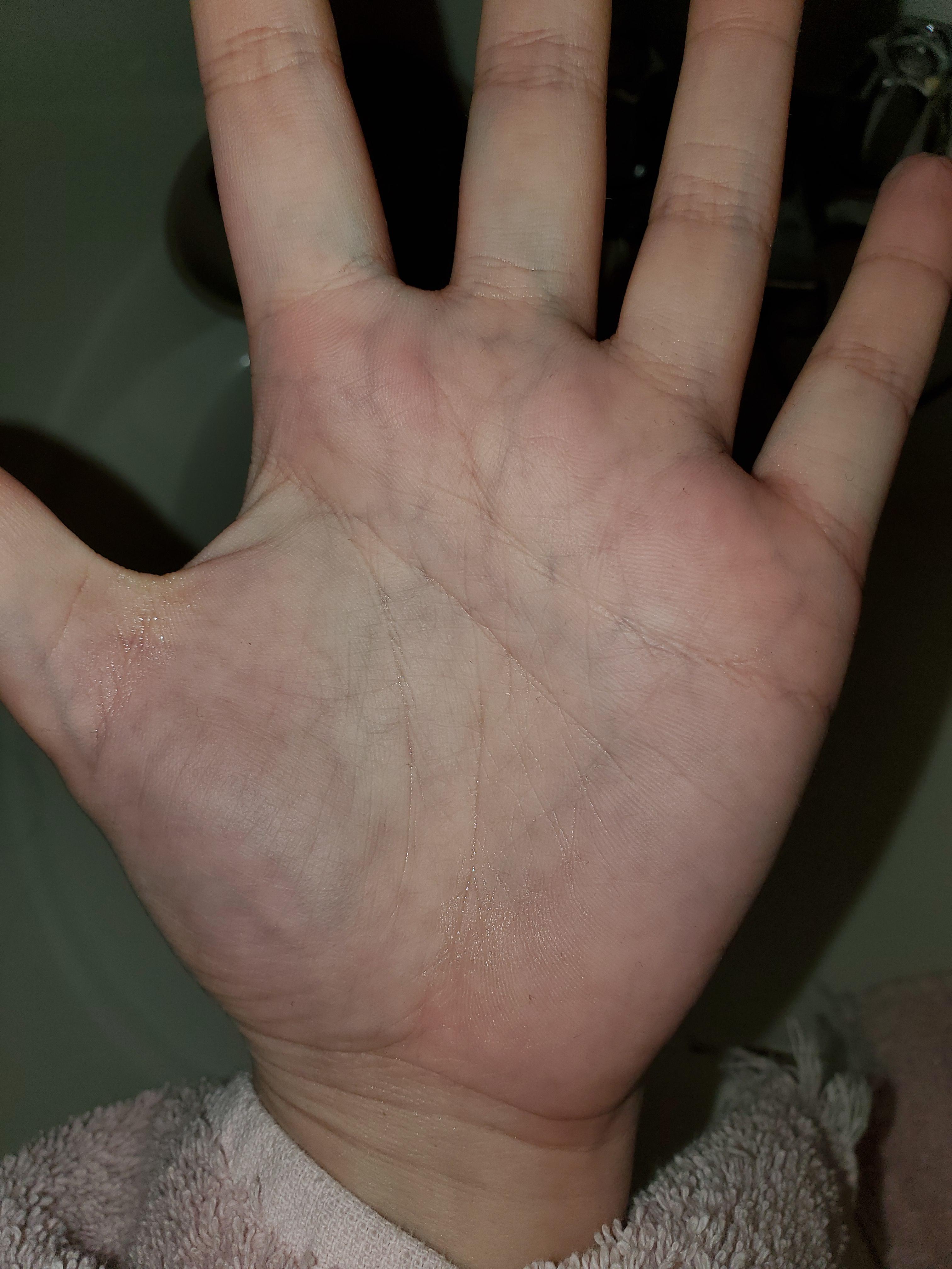 The veins in my hand after a warm shower. r/mildlyinteresting