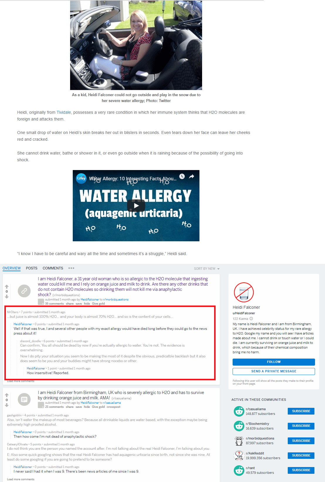 Woman who has a ''severe water allergy'' ALSO has a magical immune