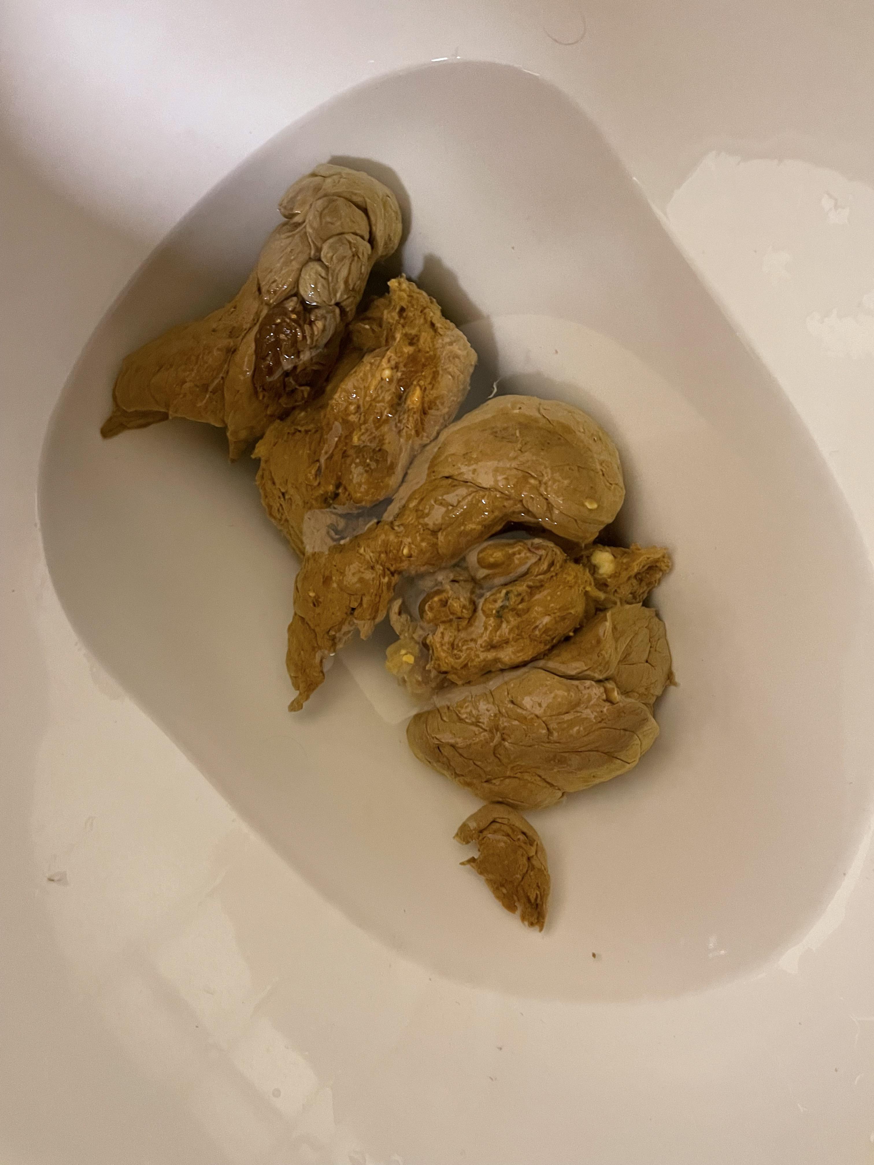 Why random dark spot in poop? r/poop