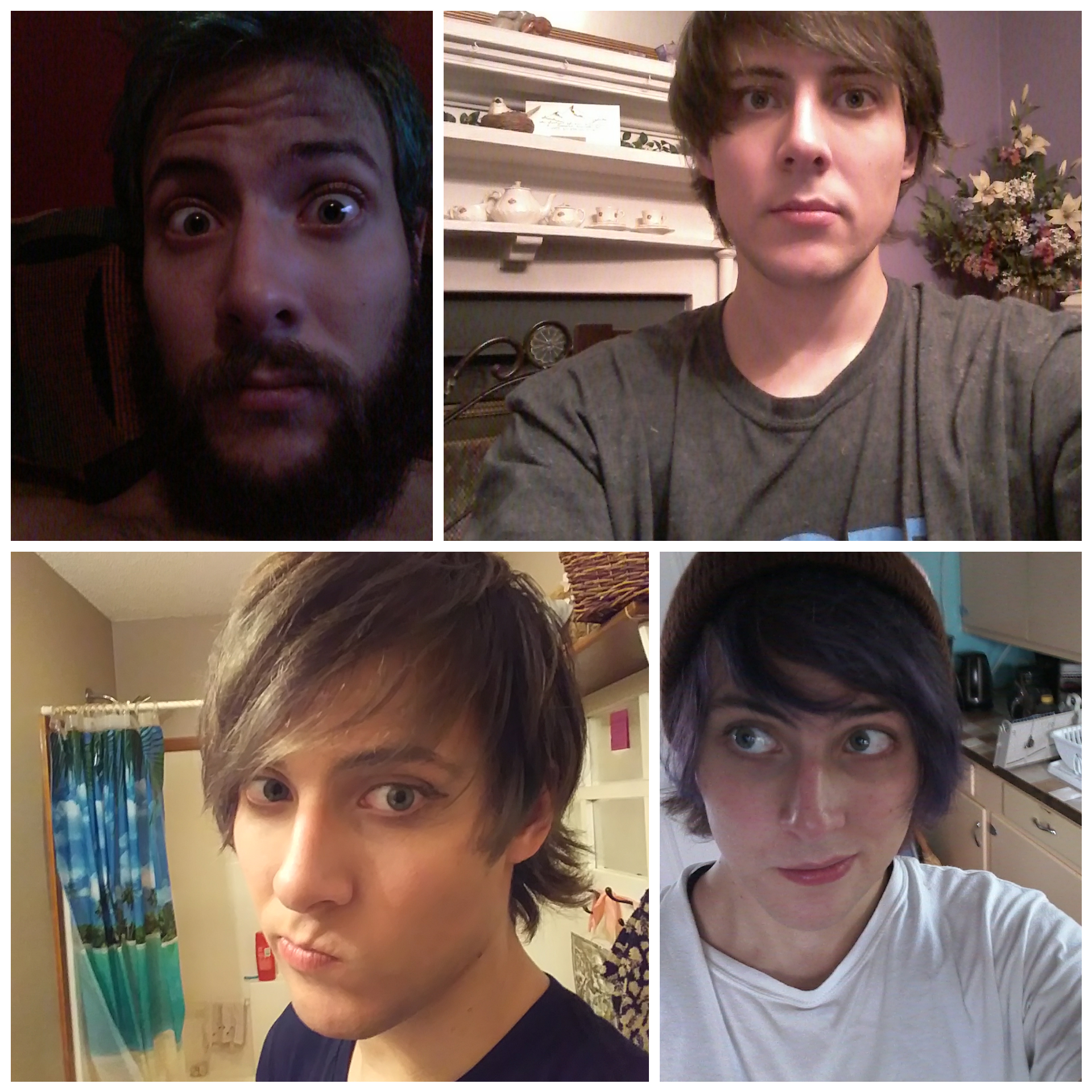 4 Months HRT / 4 laser hair removal sessions / 26yrs old (featuring