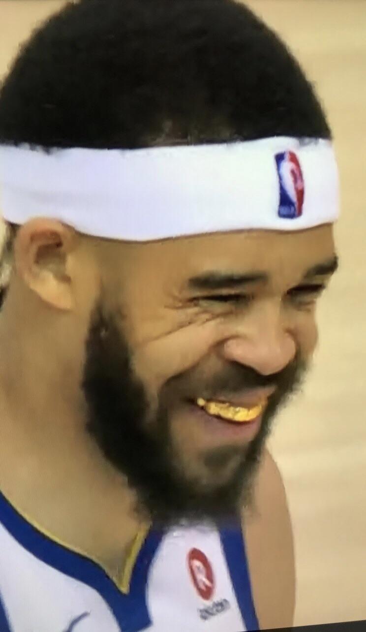 Javale McGee wears a Grill against the Grizzlies warriors