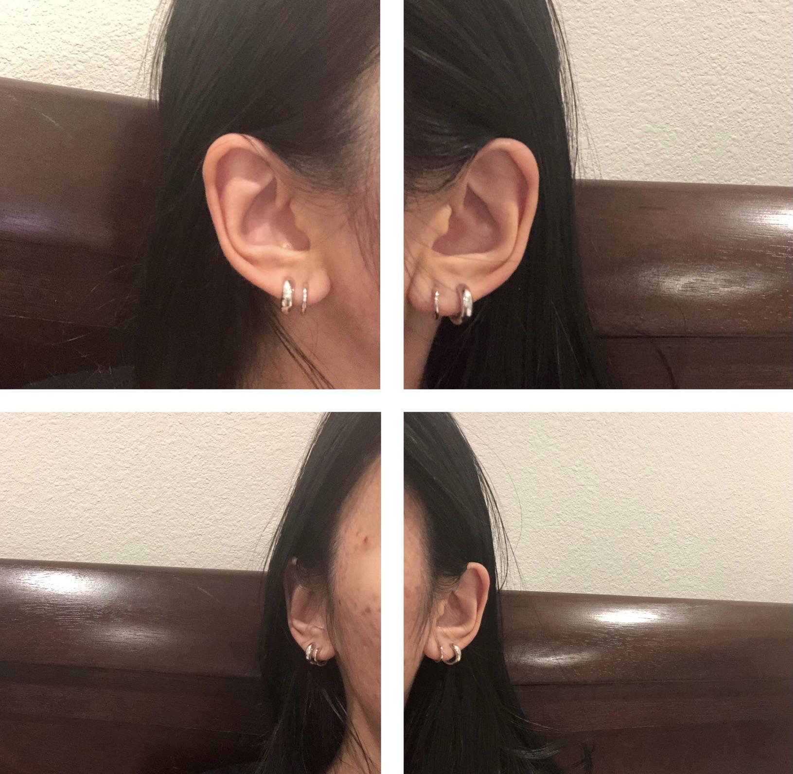 Suggestions to balance out an uneven double lobe piercing? I think it’s