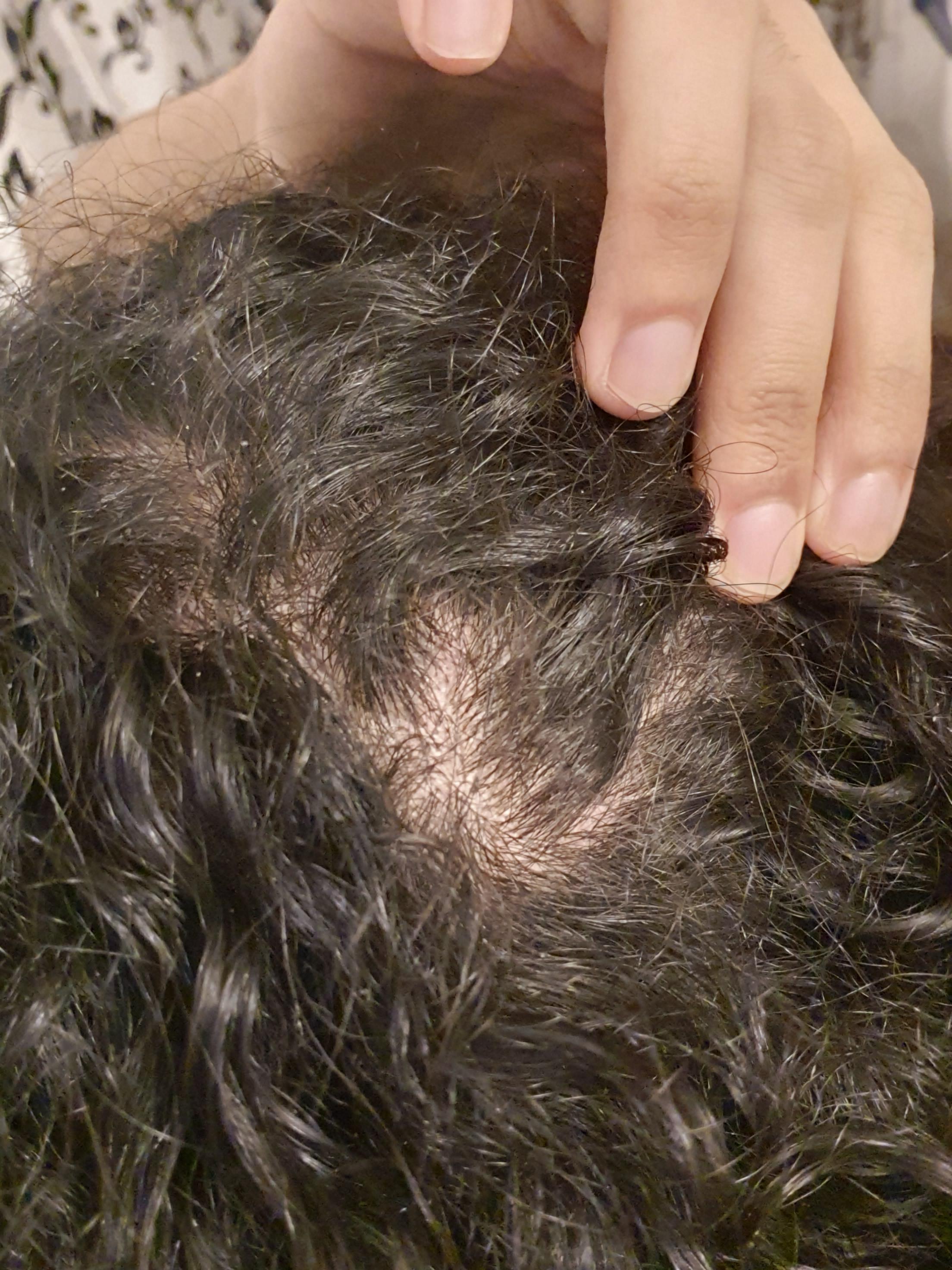 Scalp visible on crown? My hair is curly and clumps quite a lot but