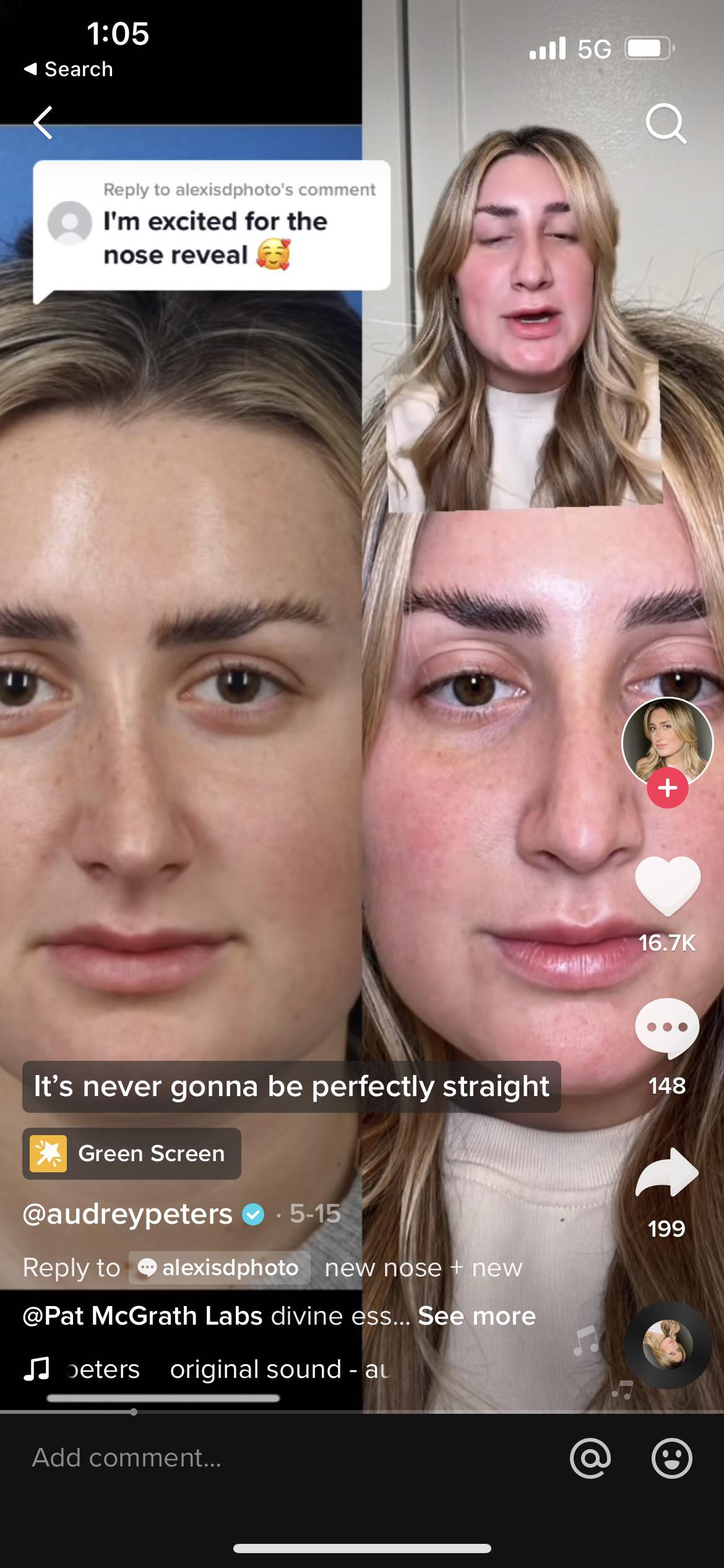 I almost feel bad for her. Her nose went from crooked one way to the