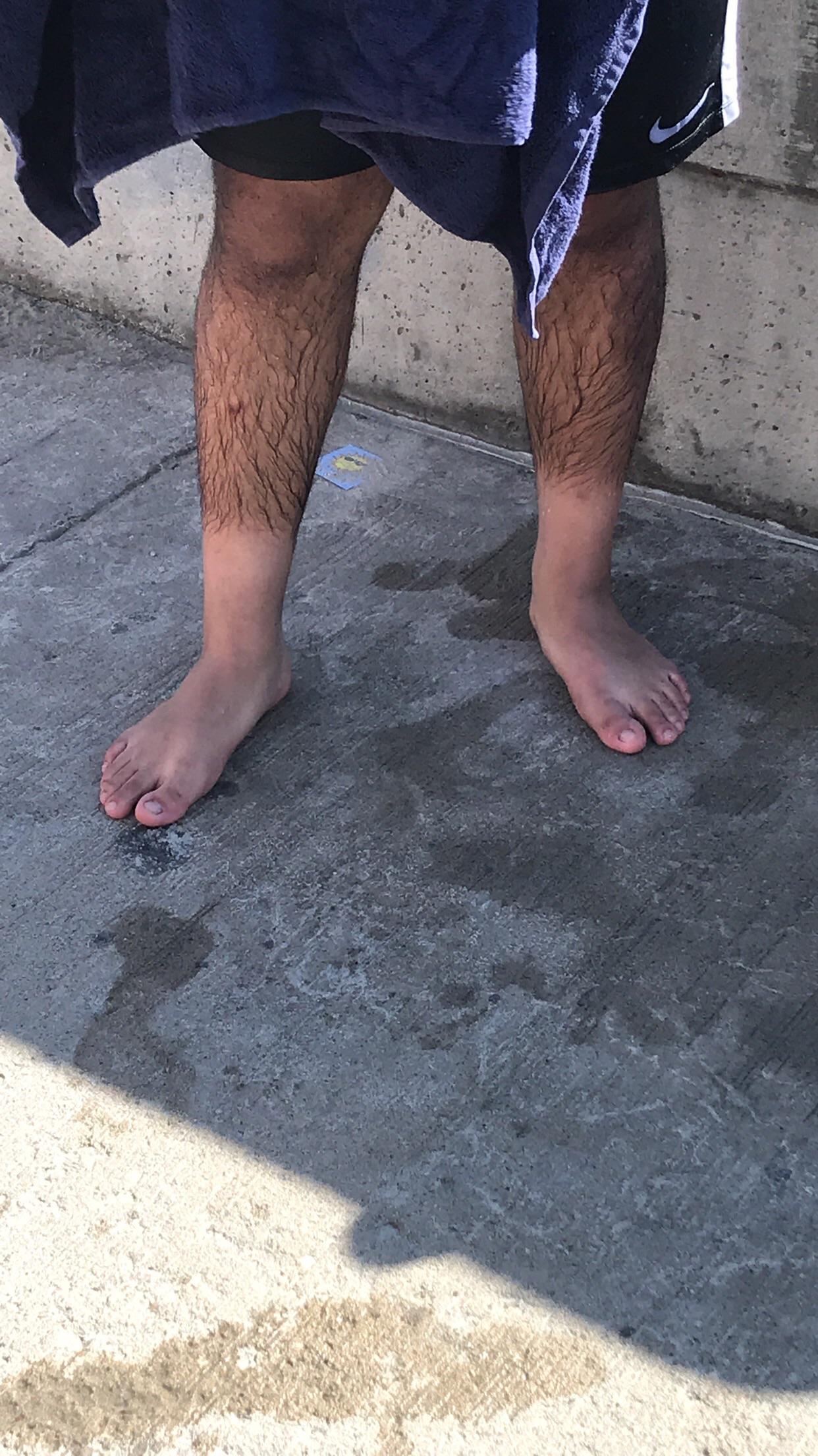 How my friends leg hair gives up about 2/3 of the way down r