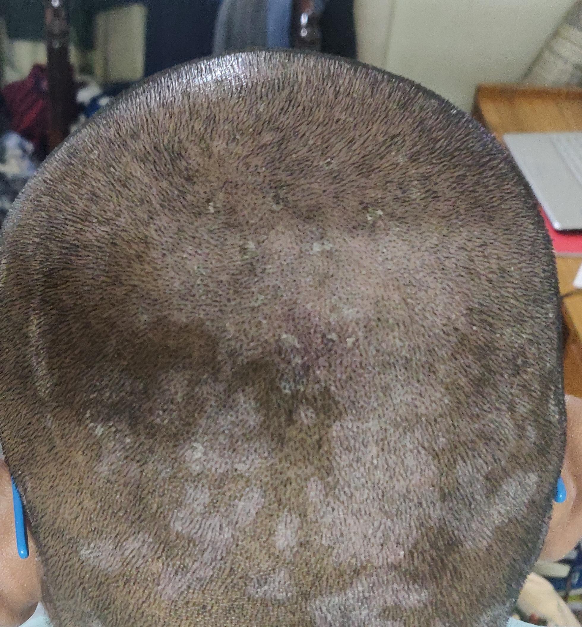 god dayum! shaved again r/dandruff