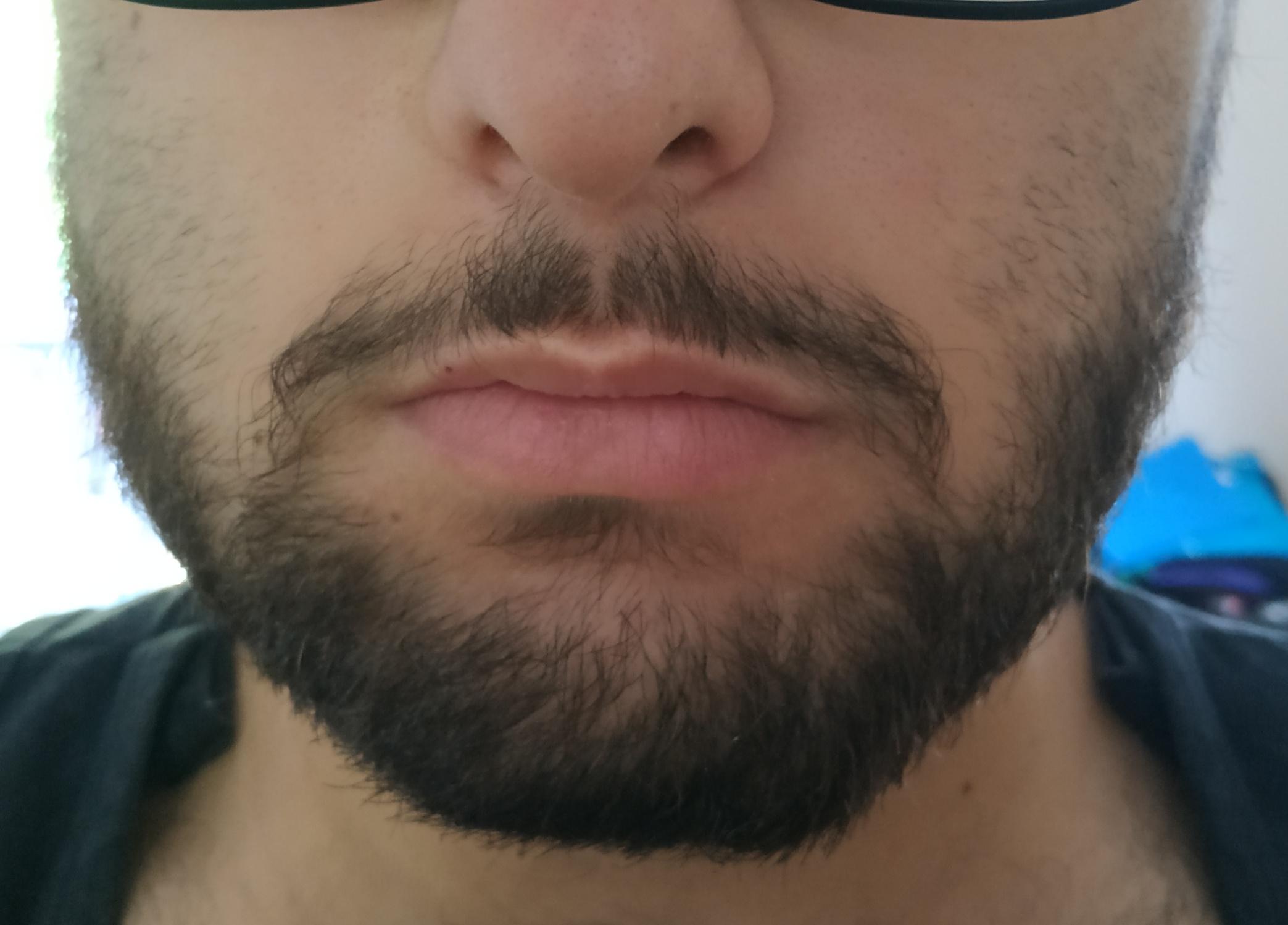Guys I'm 19 and I have a beard structure like this. I want my mustache