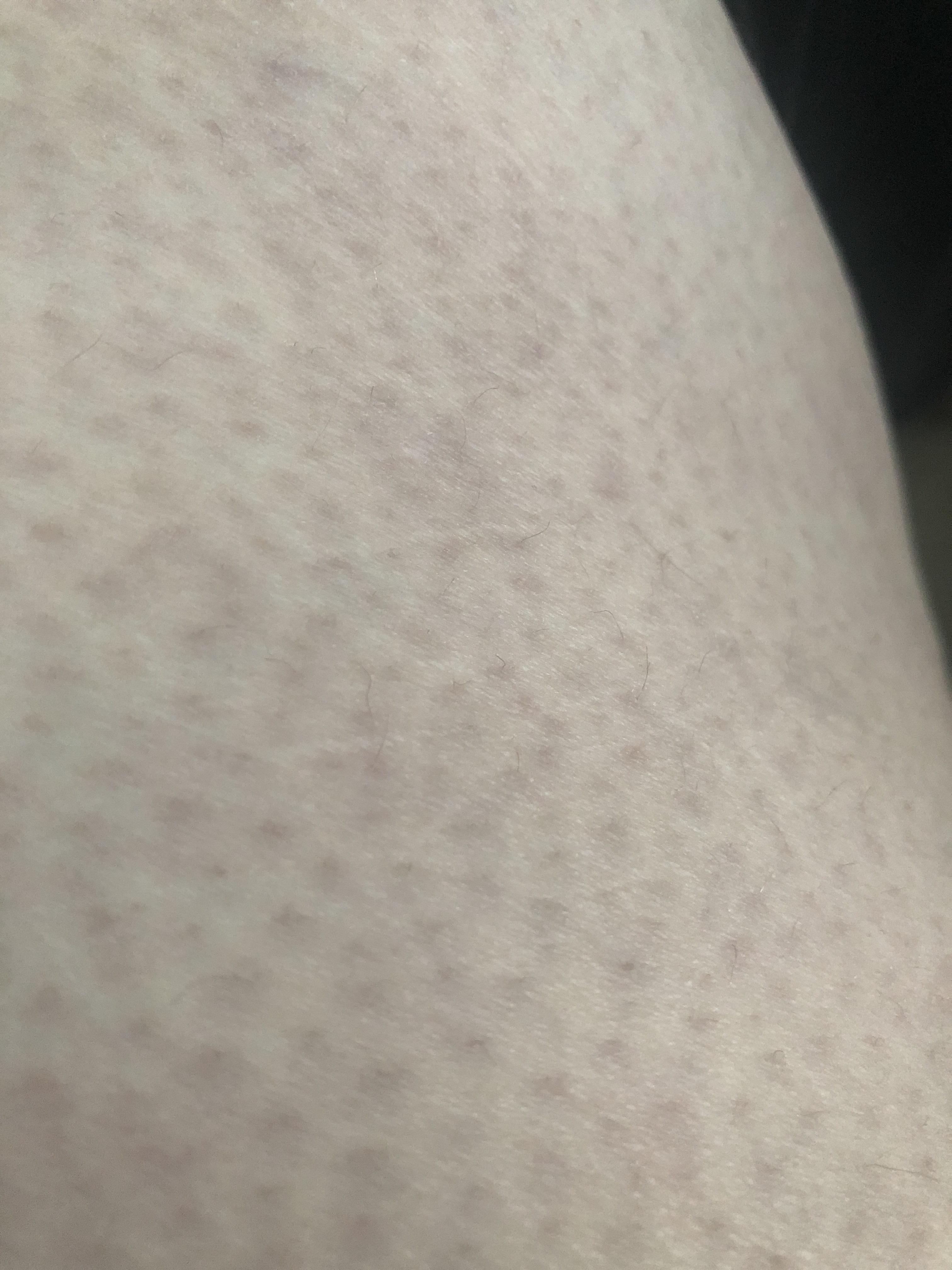Anyone know what these dots are on my legs?? They are all over, have
