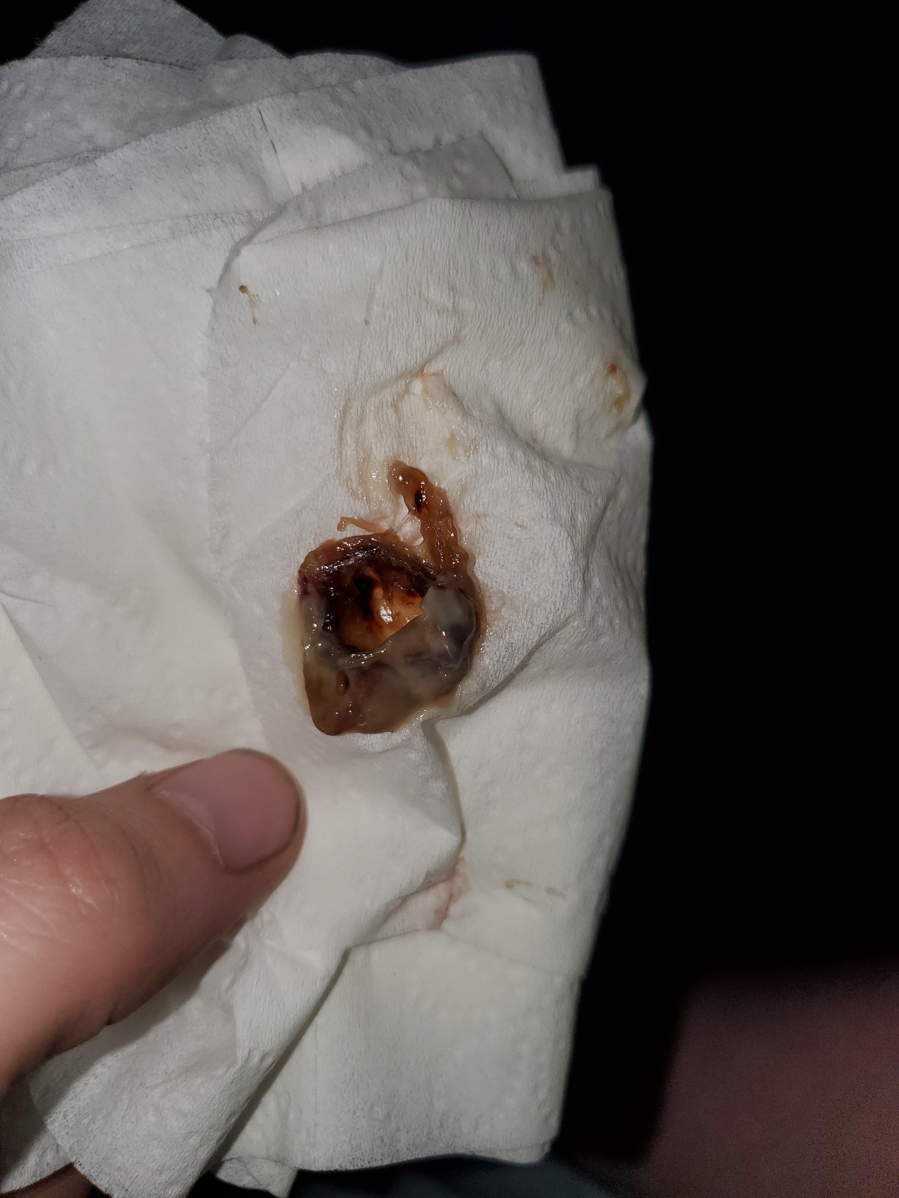 Wow... just wow. r/boogers