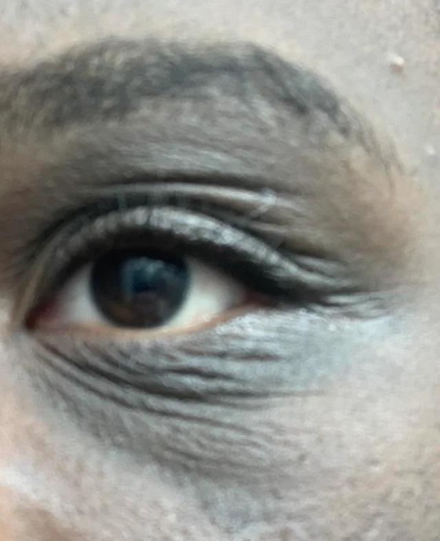 How do I get rid of the wrinkles around my eye? r/SkincareAddicts