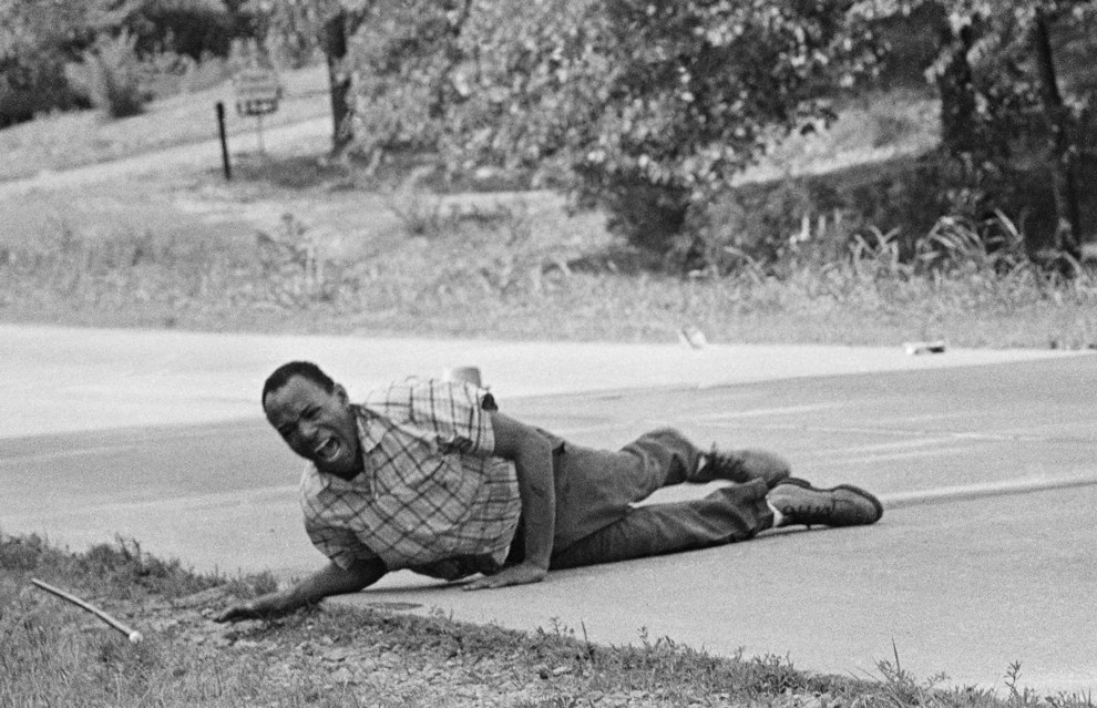 Civil rights activist James Meredith grimaces in pain as