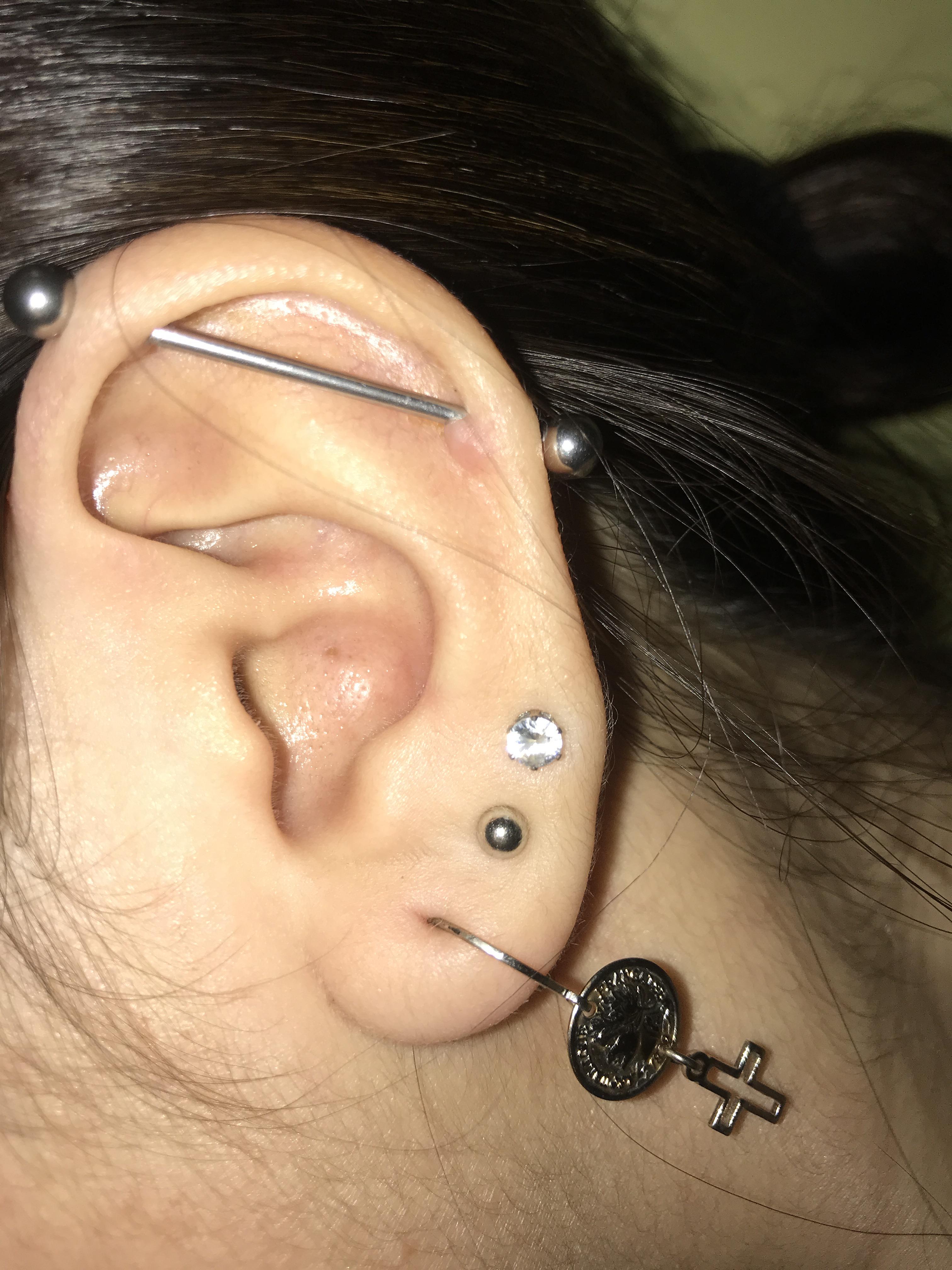 irritation bump or keloid? I’ve had my industrial piercing for about 2