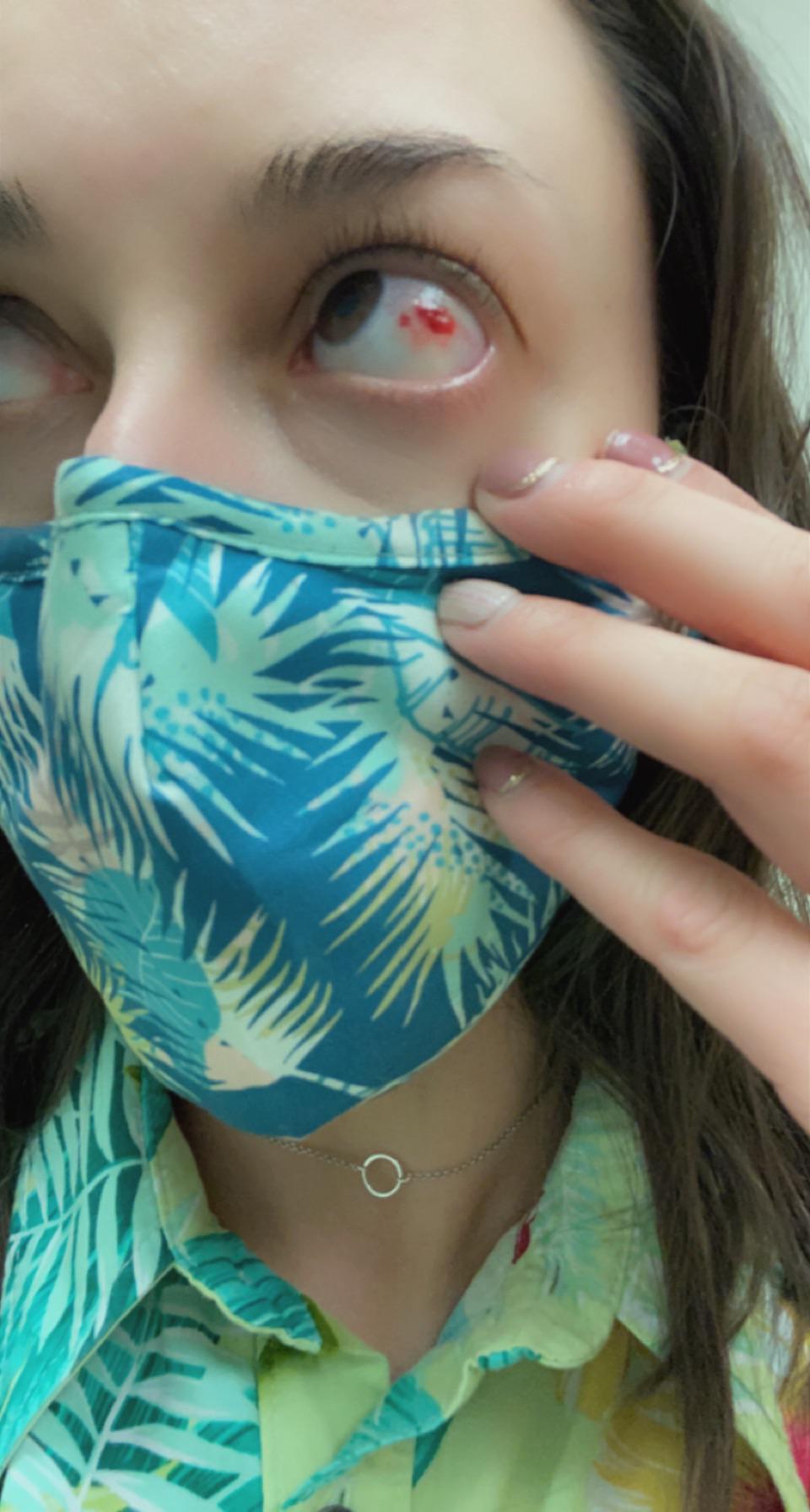 I accidentally gave myself a paper cut...on my eyeball. It was at work