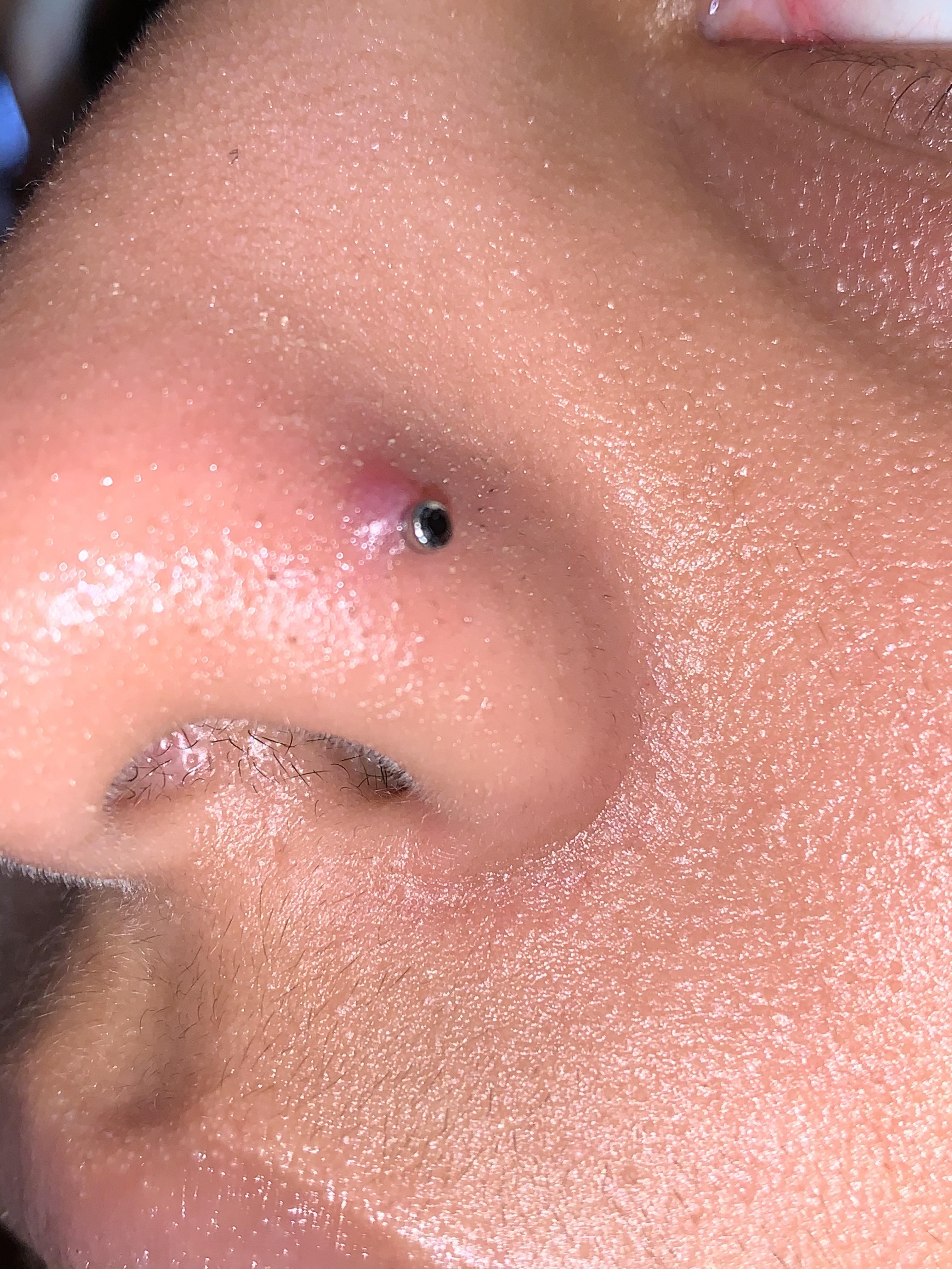 HELP!!! nose piercing bump,,, it’s been almost 3 weeks since i got it