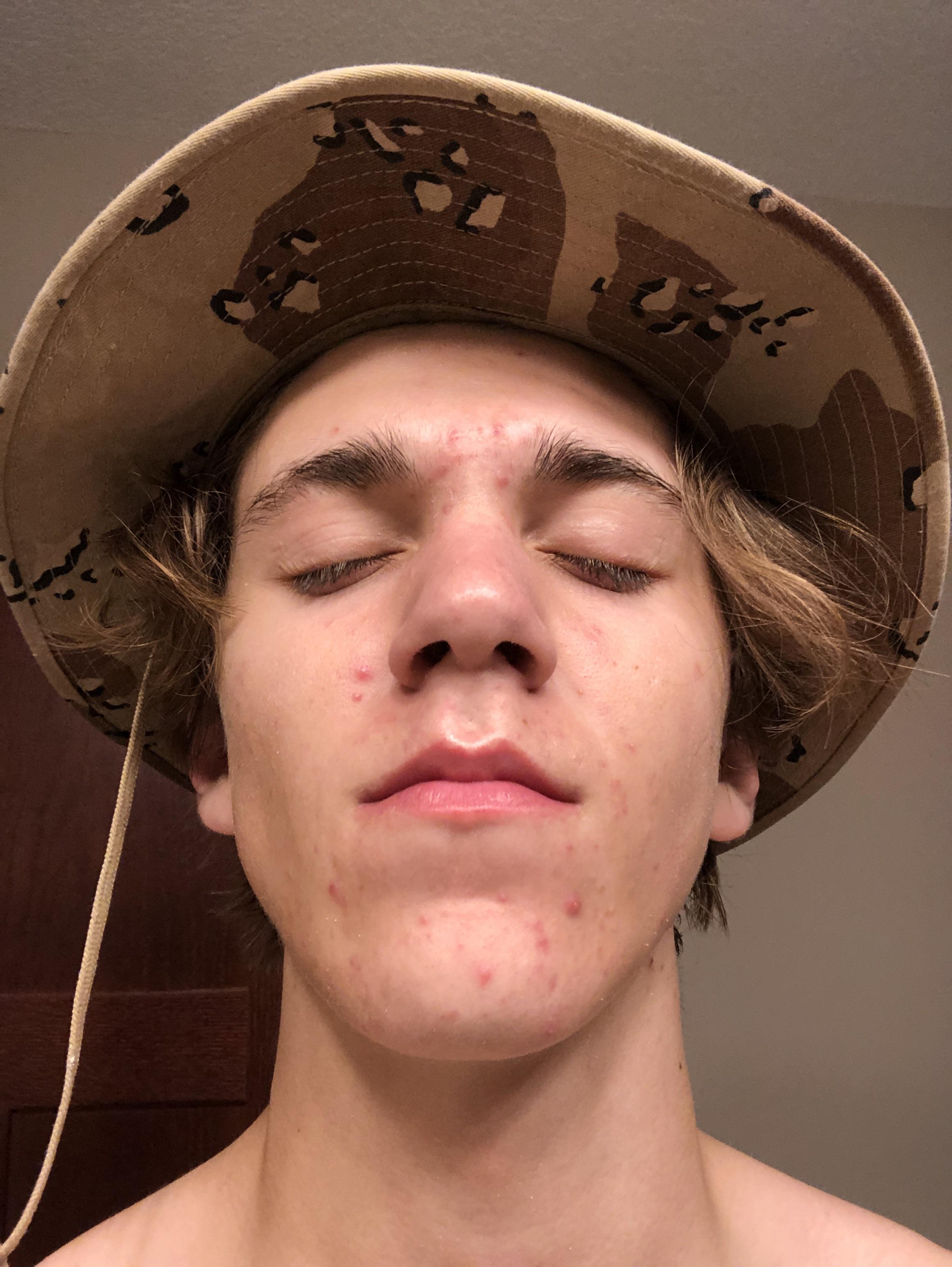 I Wash my face every morning and night and apply care to my face? Whats