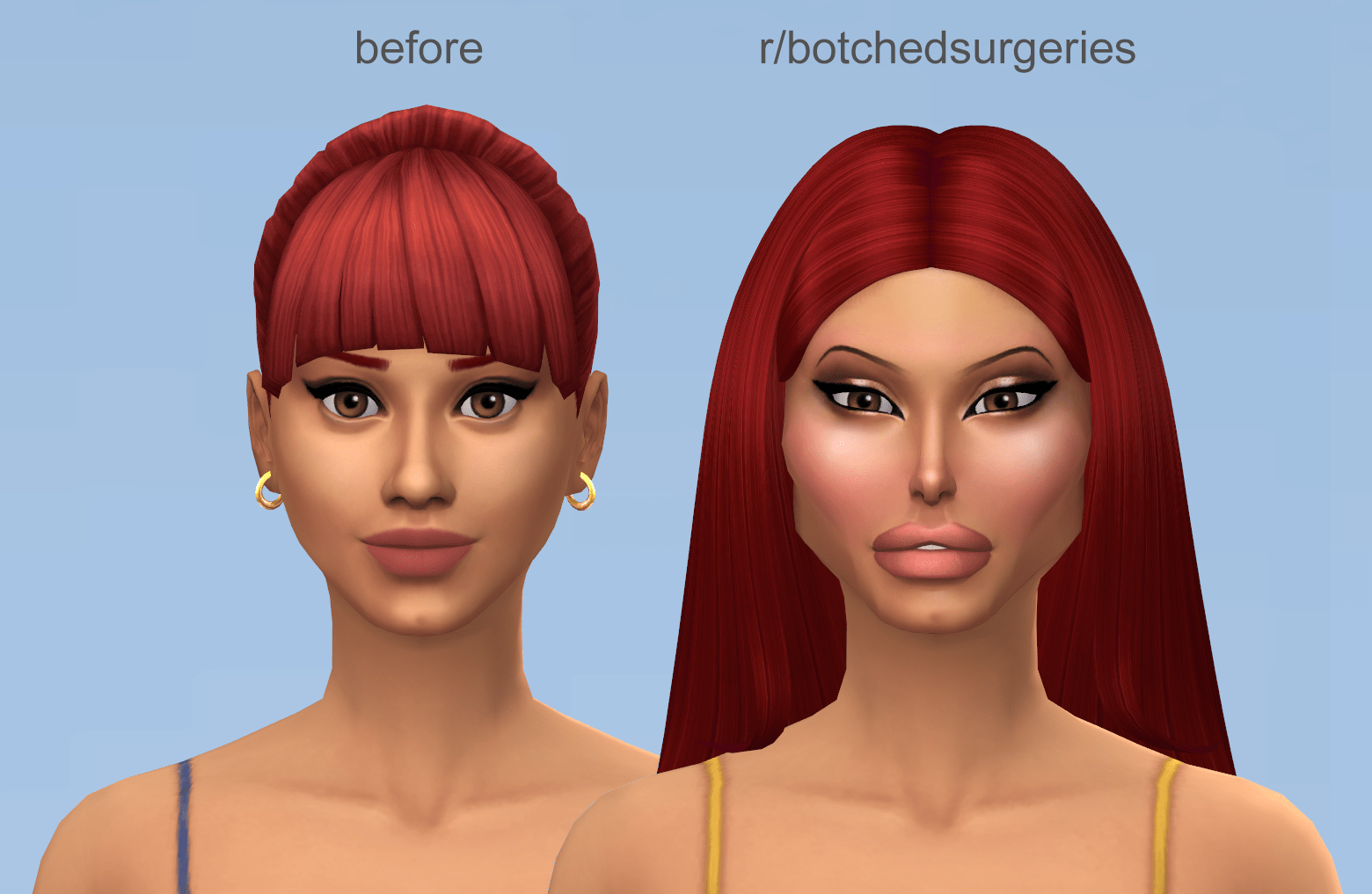Sims 4 Explore Mod Plastic Surgery
