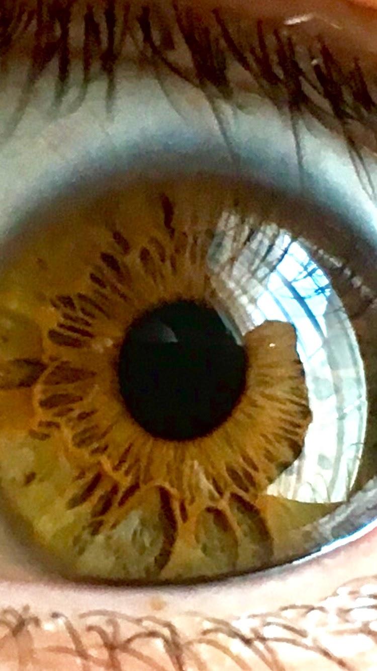 Sunflower eyes r/eyes