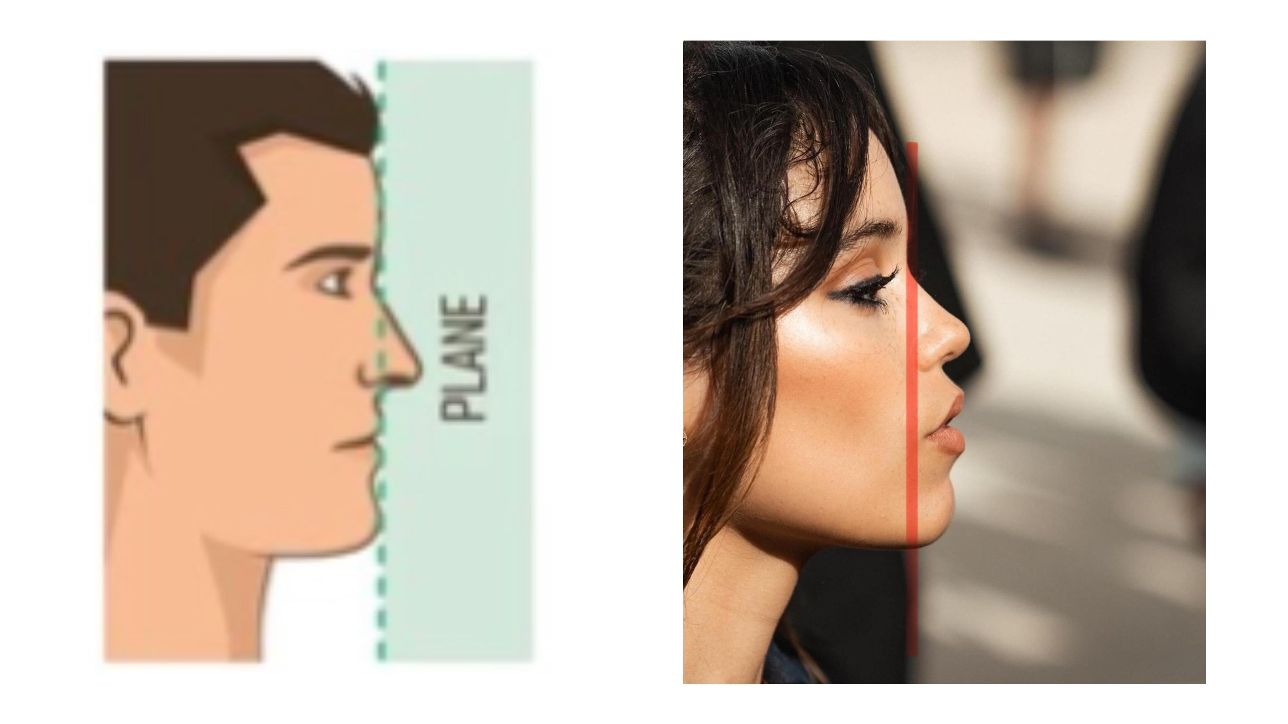 What‘s the difference between having your forehead, upper jaw and chin