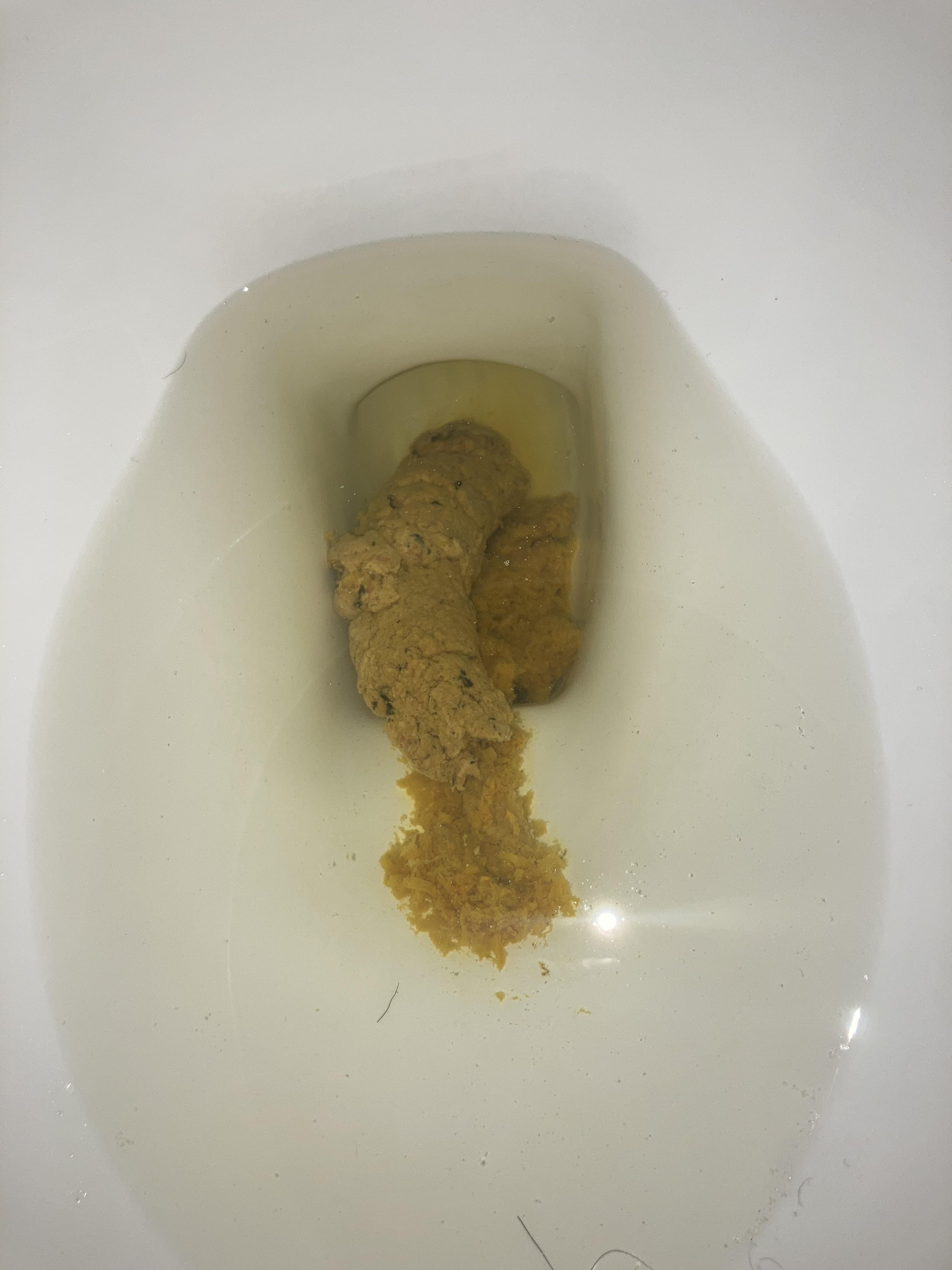 Pale stool? r/AskDoctorSmeeee