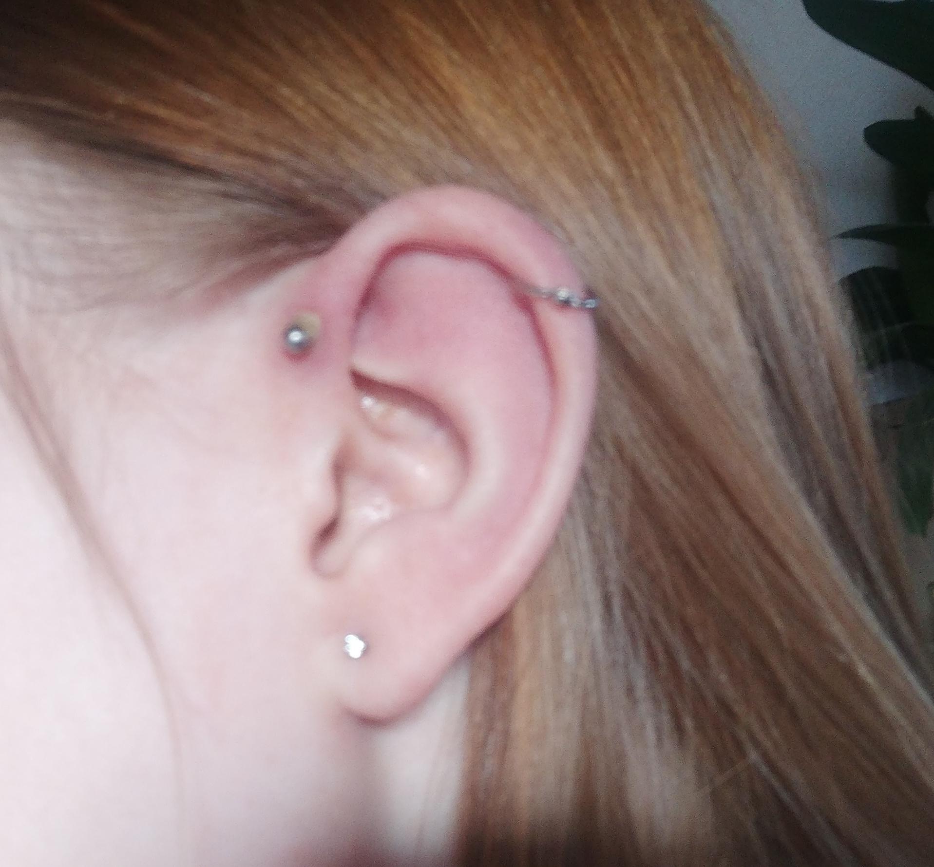 Does this look ok? I got the forward helix a few months ago and it has