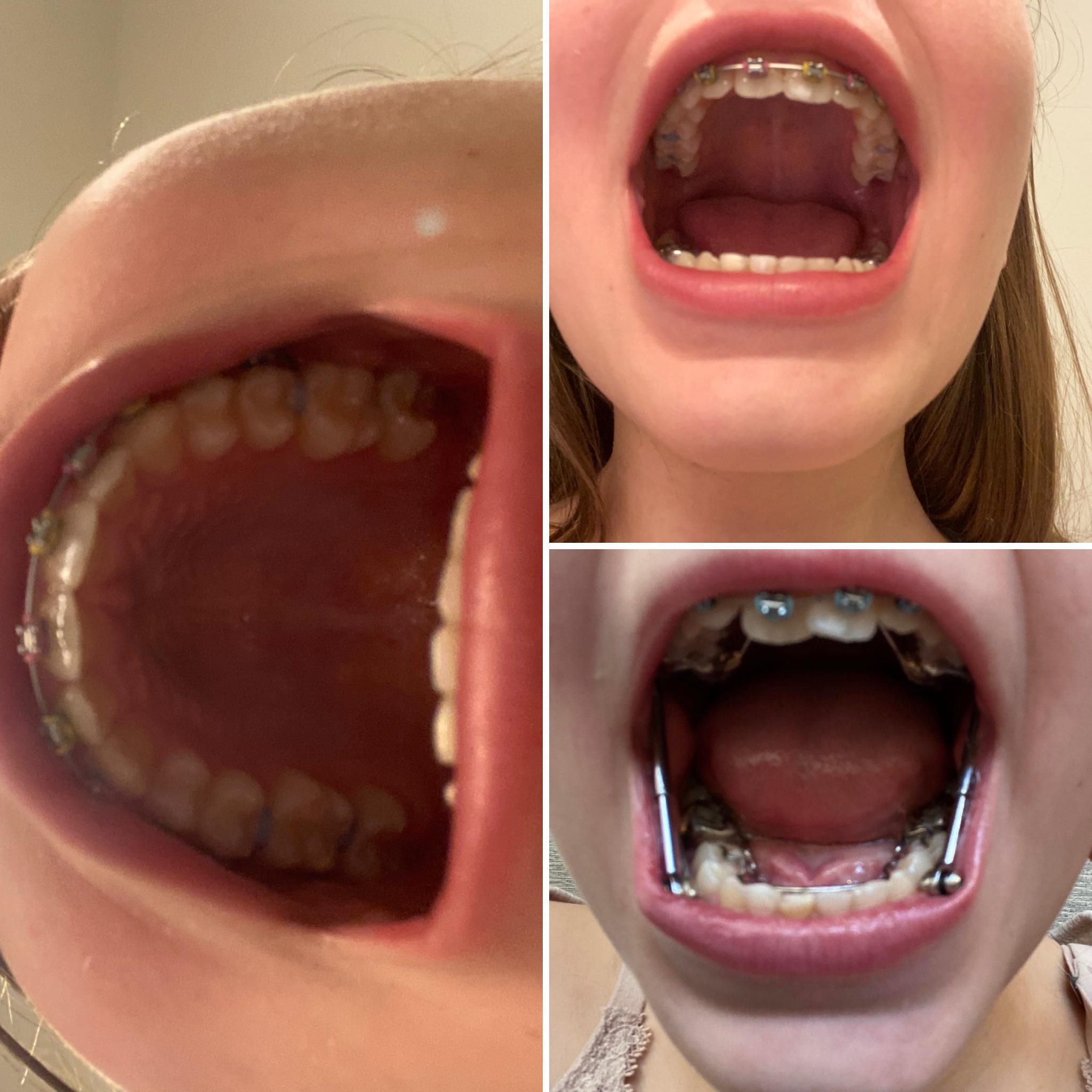 I can’t believe my teeth have changed this much! you don’t realize how