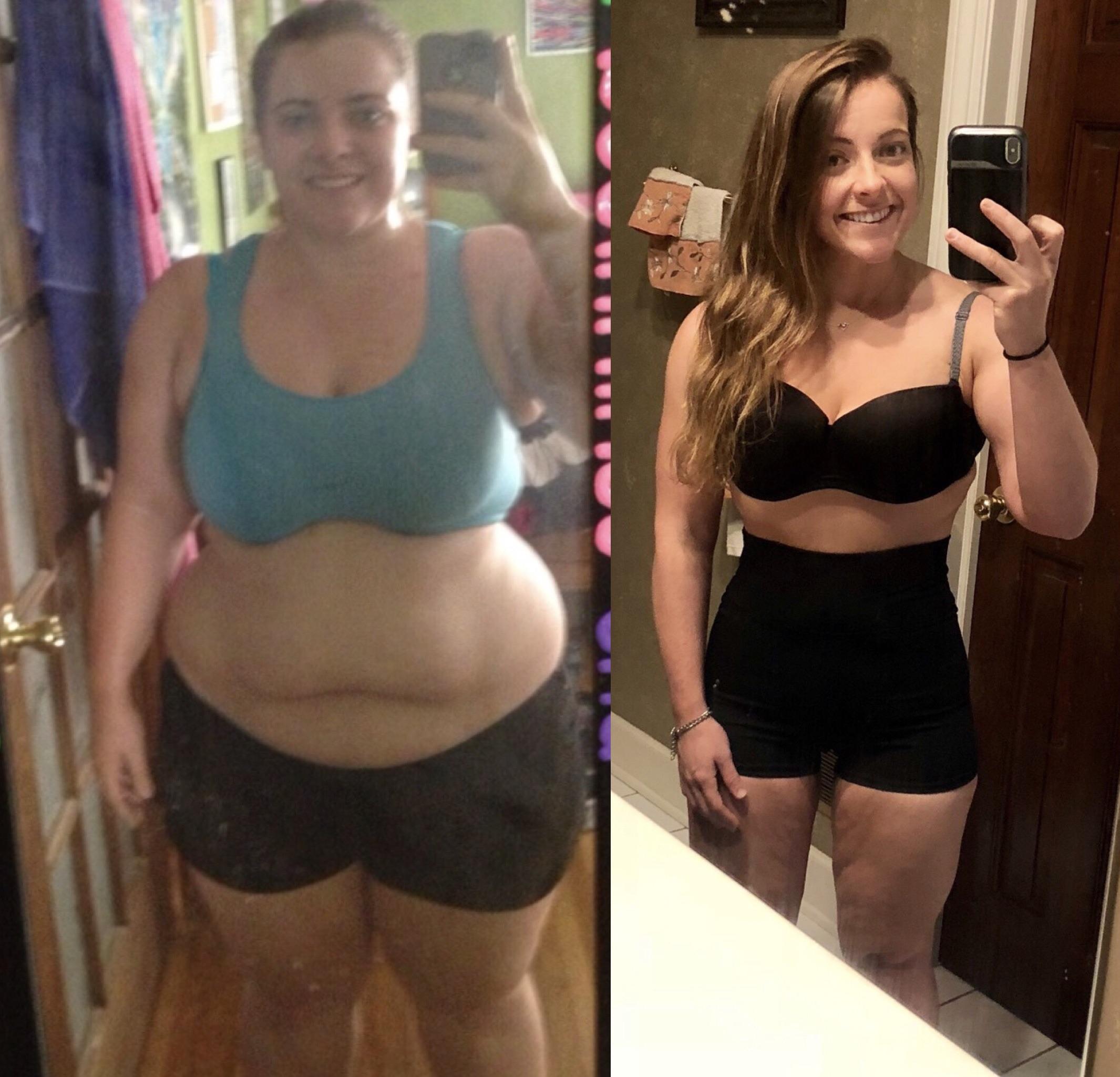 F/26/5’2[280lbs > 140lbs = 140lbs] I lost 1/2 of me, time for skin