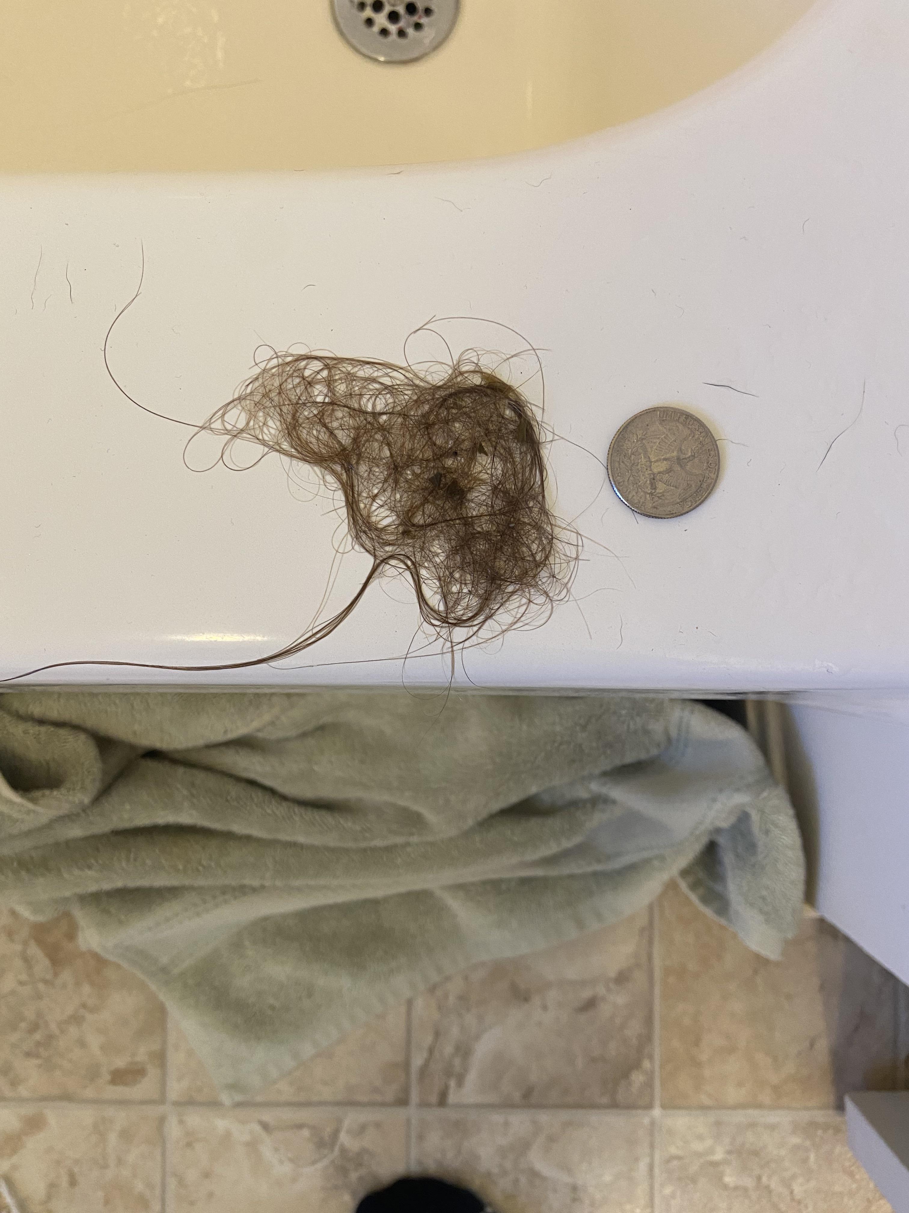 32/F. Is this a normal amount of shower loss? r/Hairloss