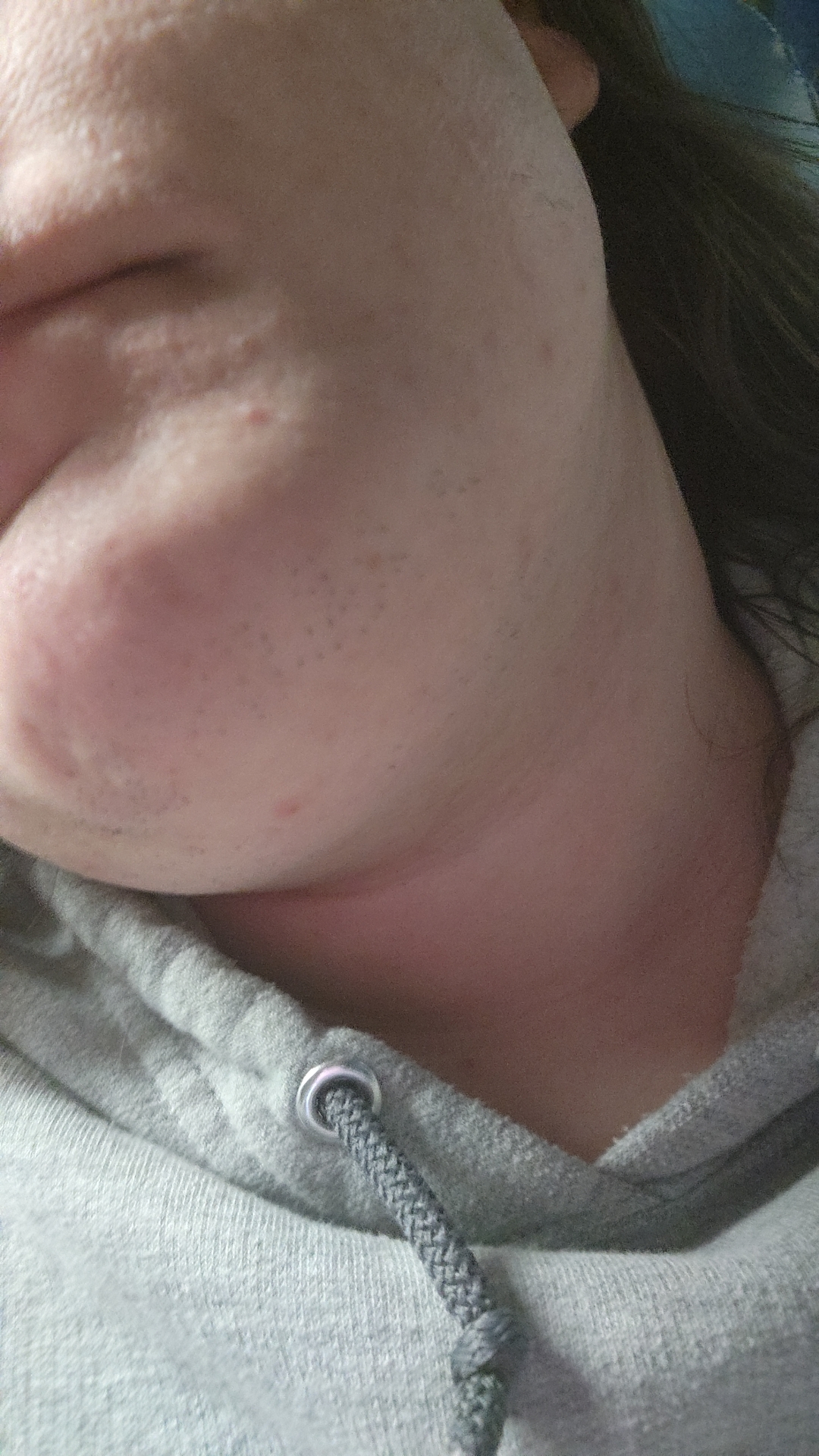 Please help my facial hair is getting worse and worse and I can't