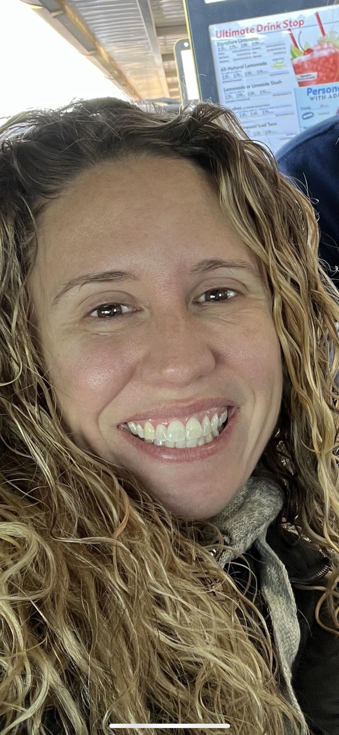 Discover more than 68 bad eye bags reddit latest xkldase.edu.vn