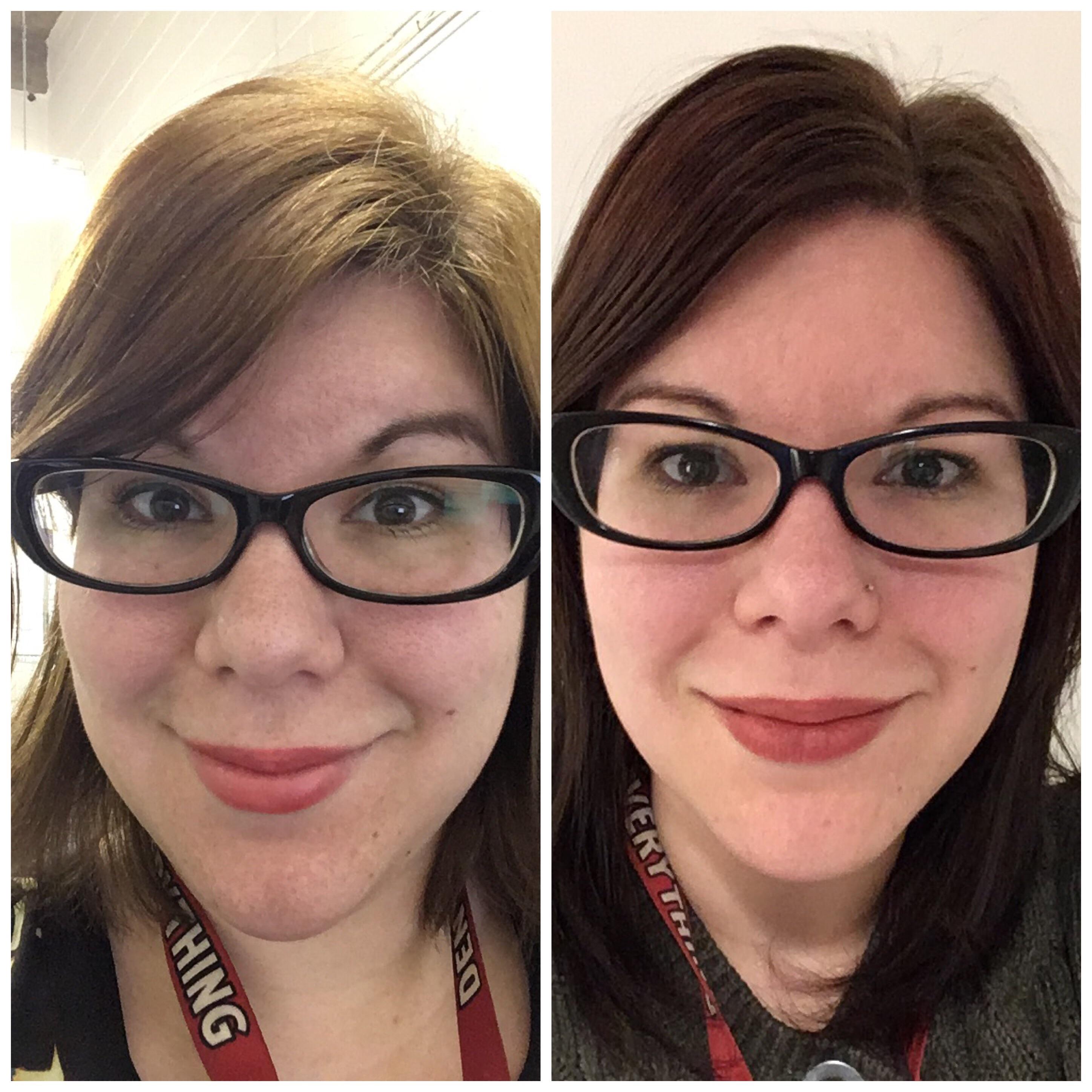 F/26/5’3.5” [195lbs > 150lbs = 45lbs] (8 months Keto) Finally losing