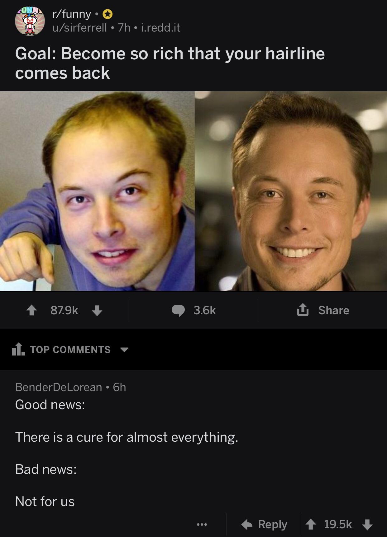 Elon Musk Meme Hairline