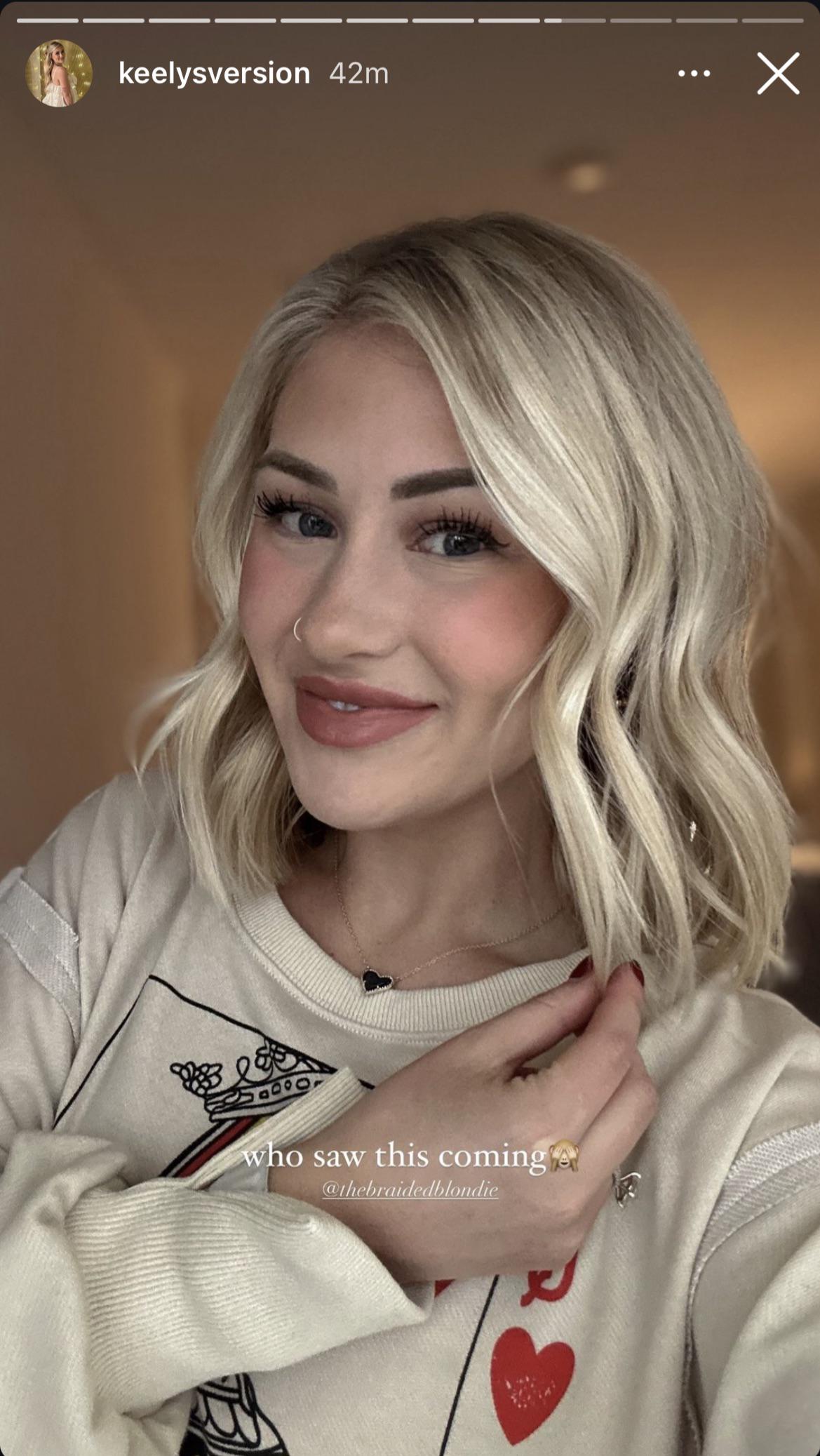 It’s giving buck teeth…… r/keelylindler_