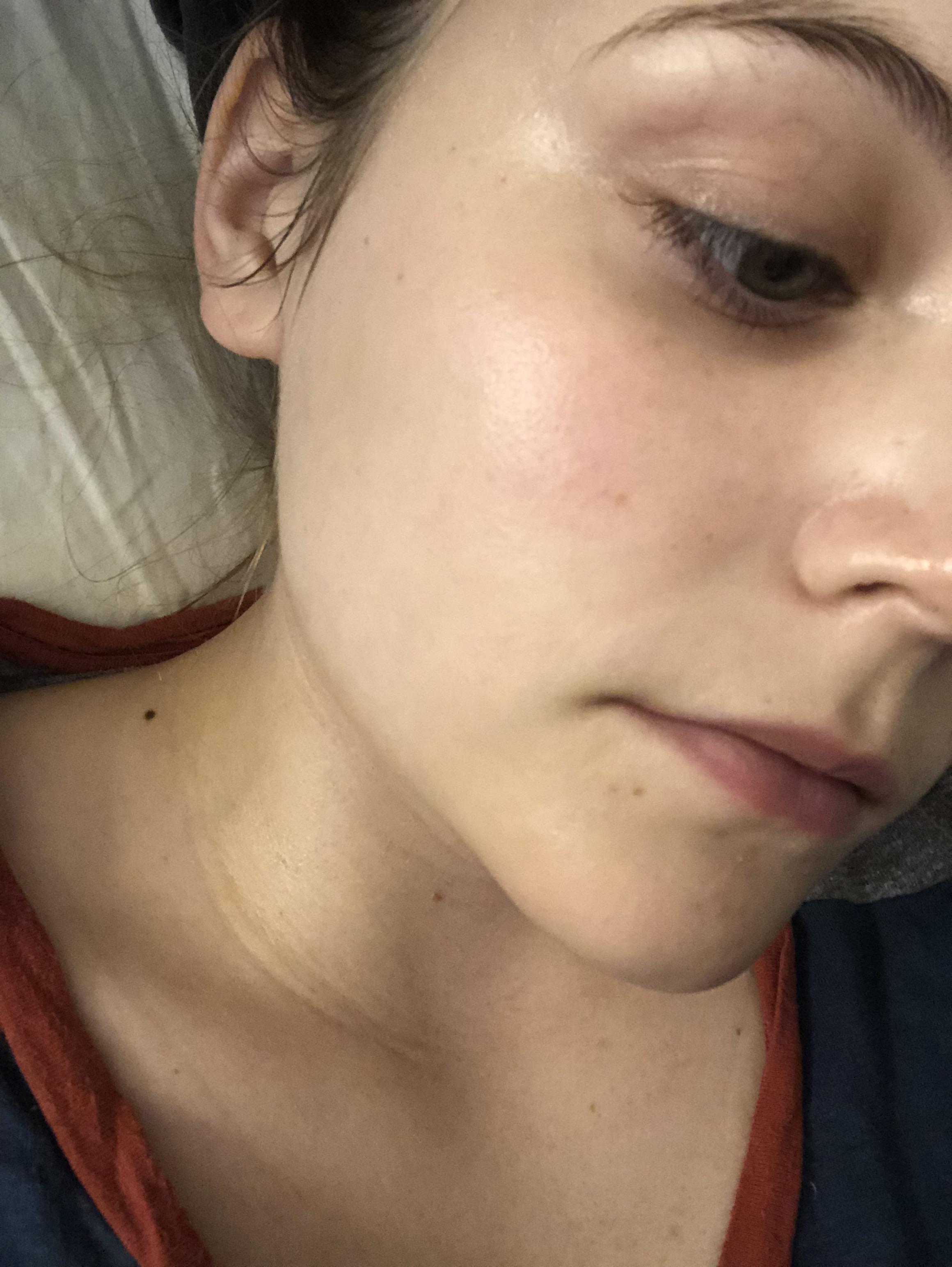 [Selfie] I started using the TonyMoly Banana Sleeping Pack and it helped my dry and flaky skin
