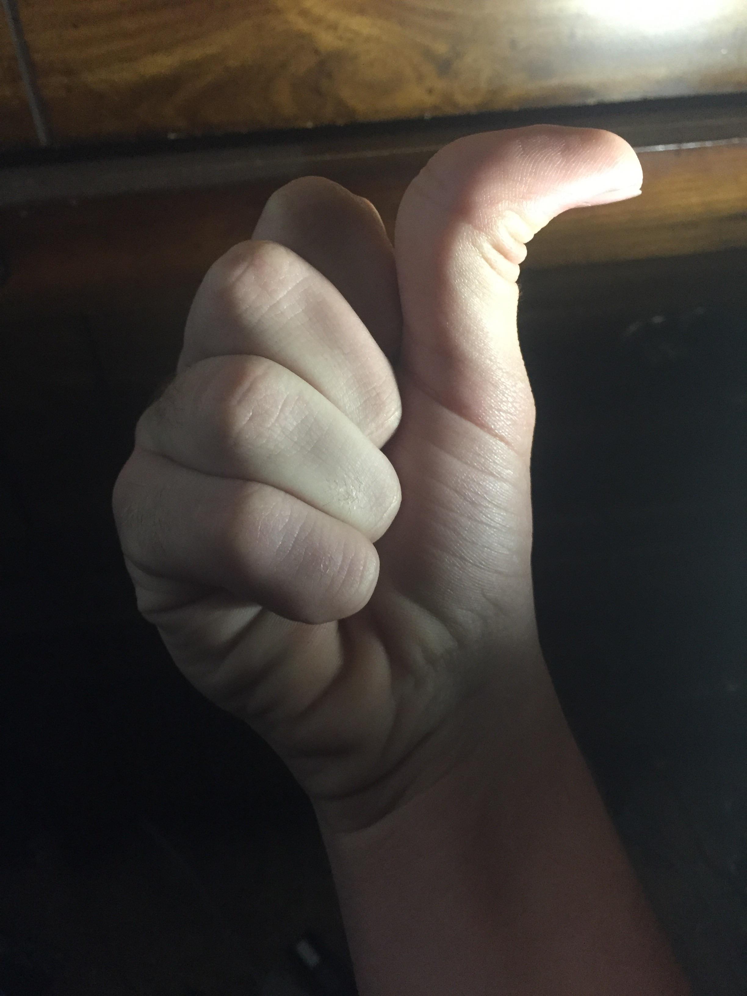 My doublejointed thumb. r/mildlyinteresting