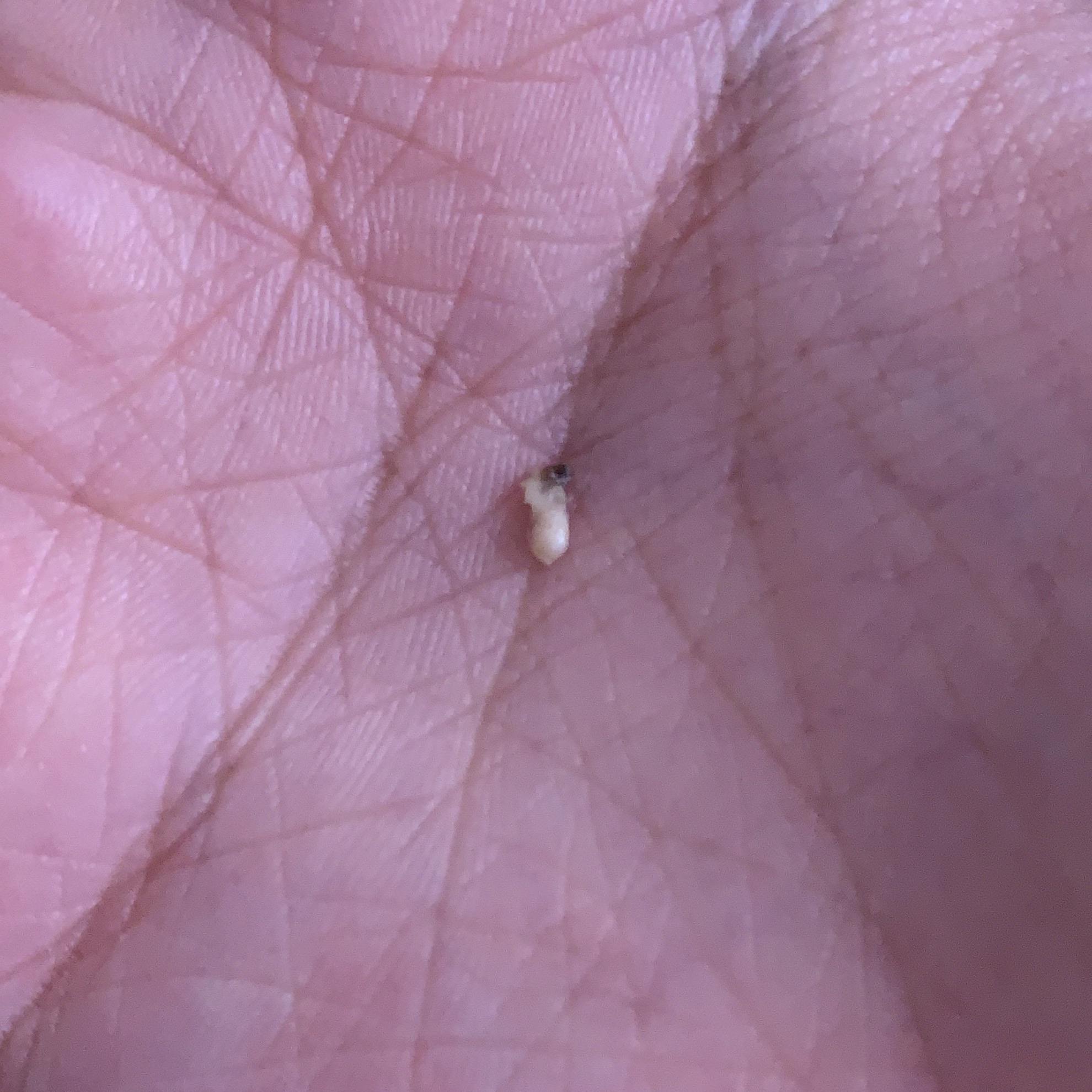pulled this from my dog’s underbelly. only the black part was visible