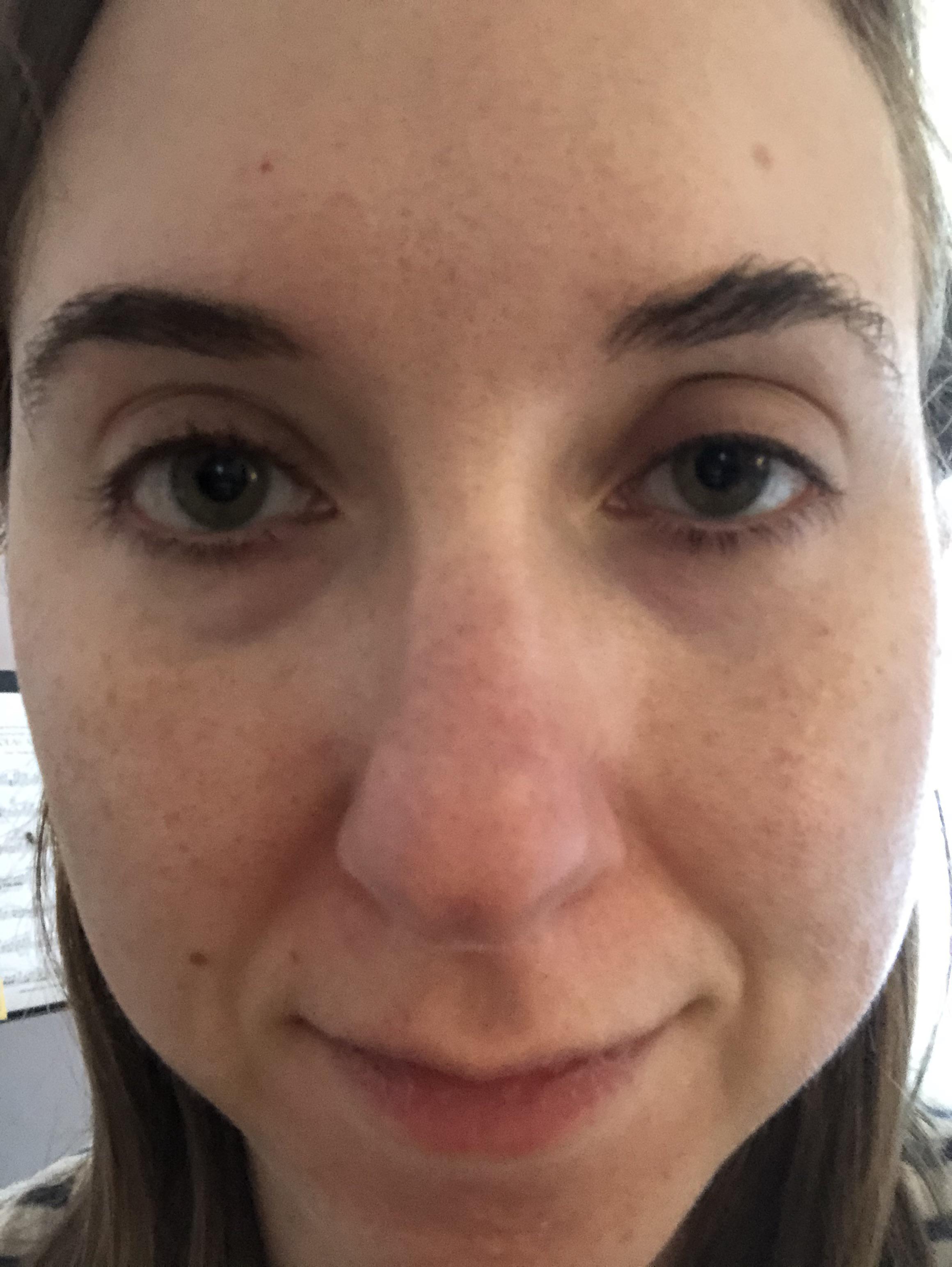 Hi, looking for advice please. I have close set, big eyes with large