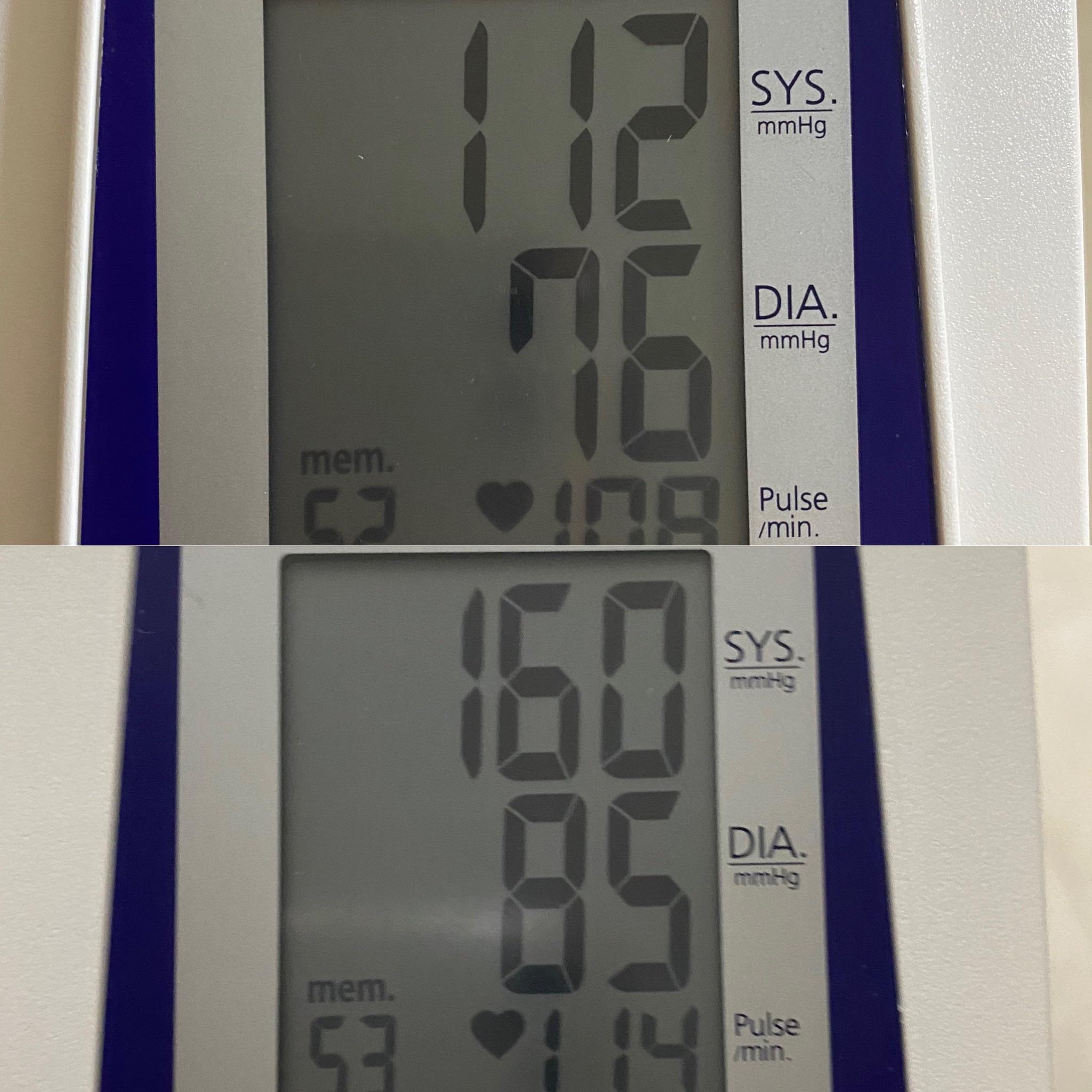 I did a heart monitor test before I stand up and after, do you think I should visit the doctor