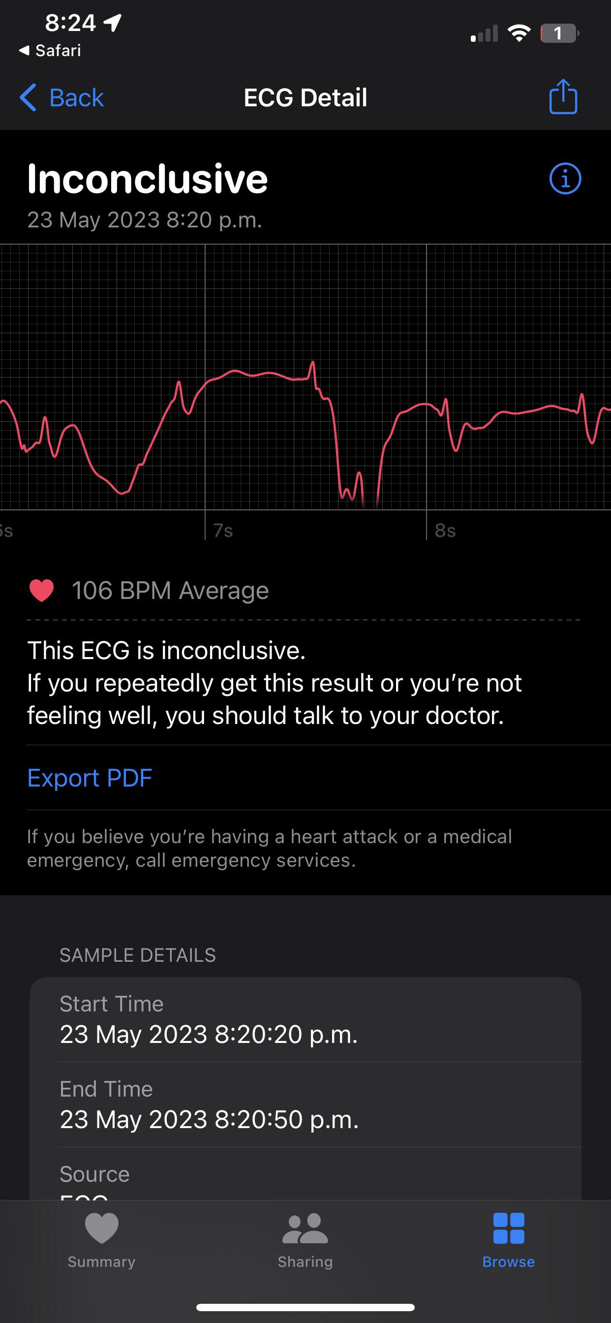 Why are all my ECG readings inconclusive? r/AppleWatch