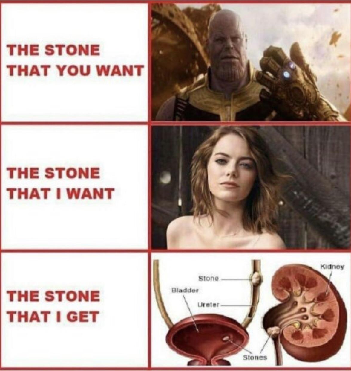 My name is Stones. Kidney Stones! r/memes