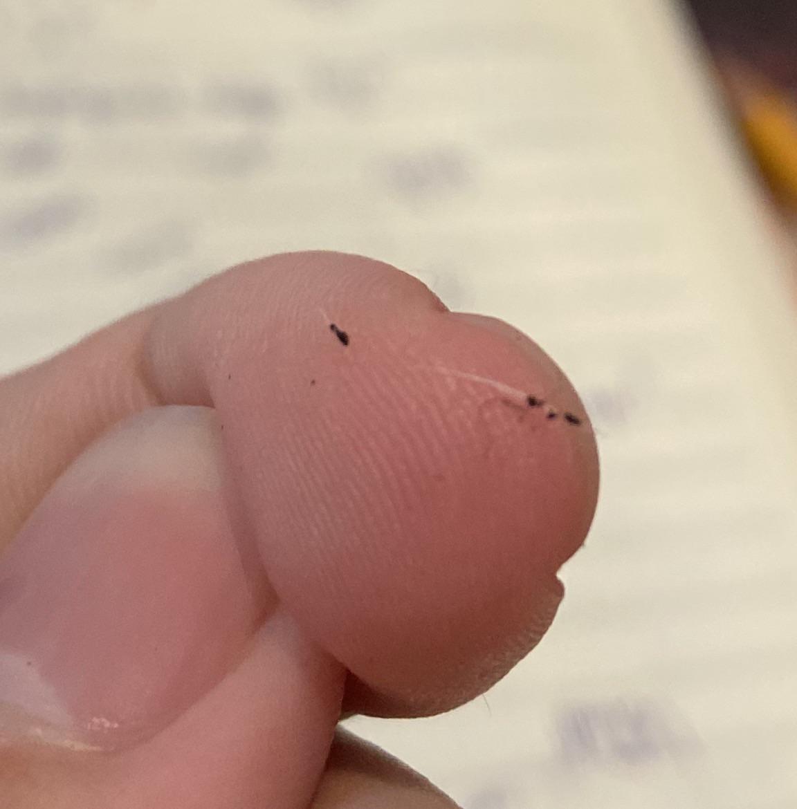 I find tiny black specks like this on my cat’s chin. What are they? r