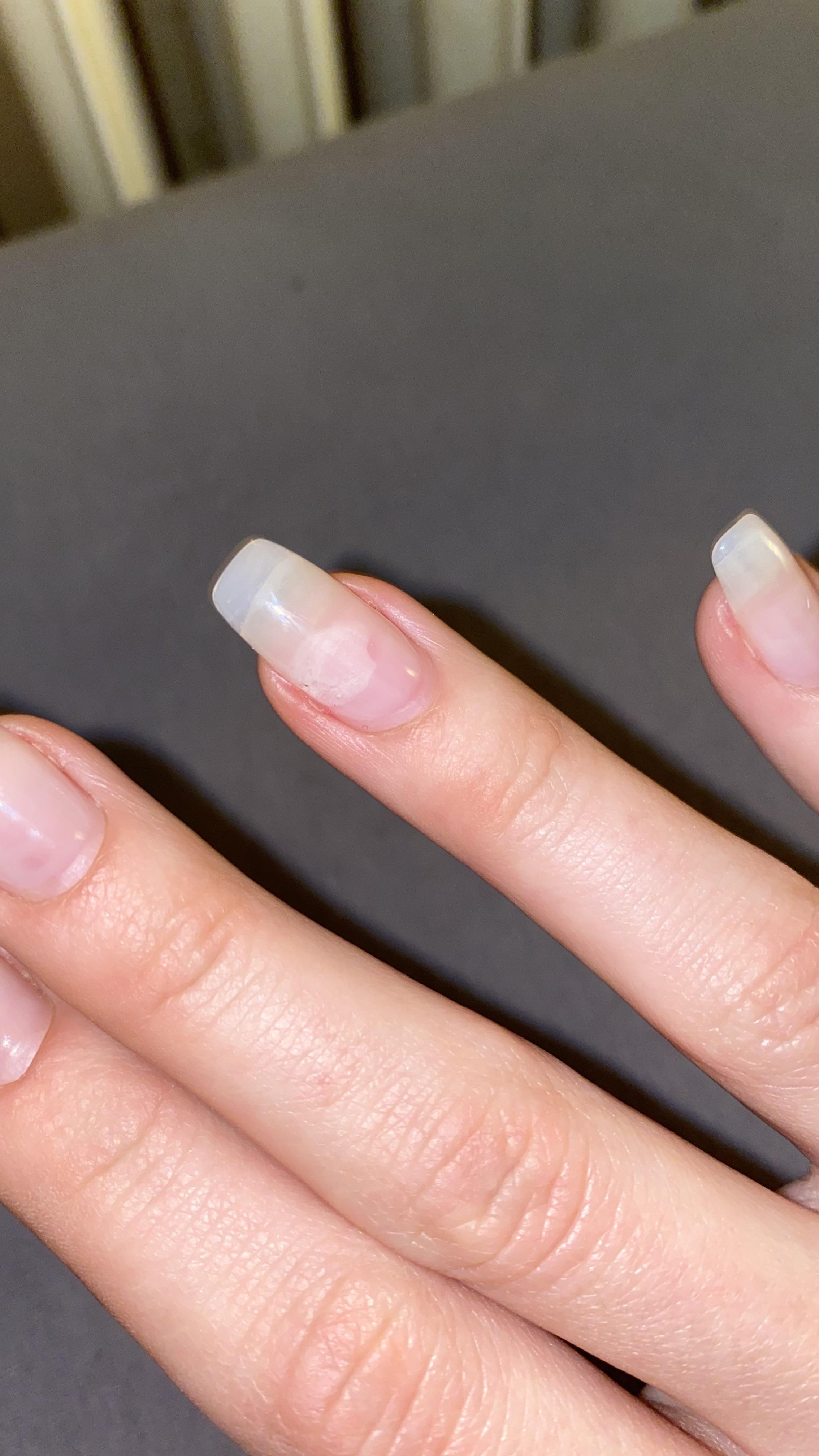 Hello, I slipped while I was cleaning and this happened, will my nail