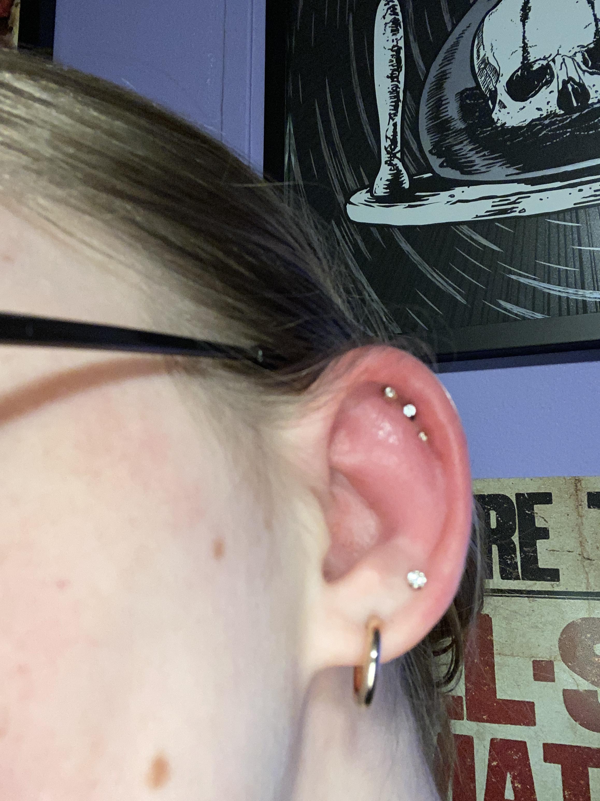 HELIX SWOLLEN I had my triple helix pierced about 4 days ago, and now