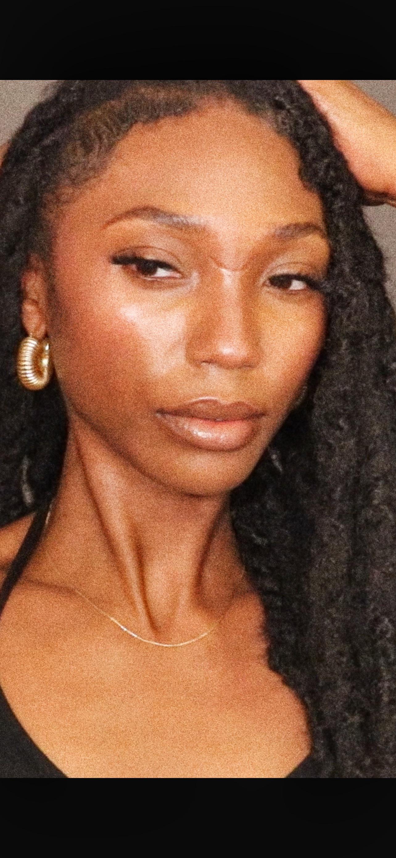 Deep facial scar healing up . I wish I could find something to just