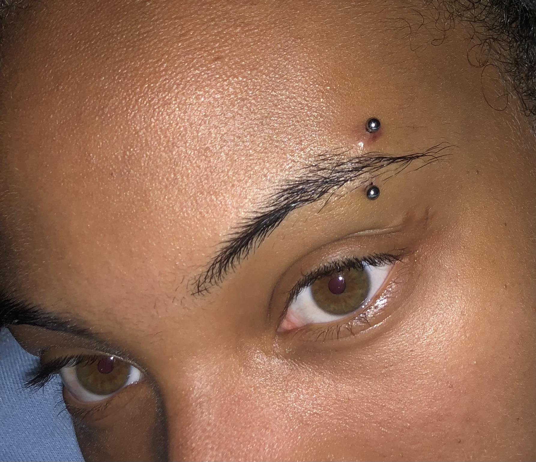 irritation bump or keloid?? r/PiercingAdvice