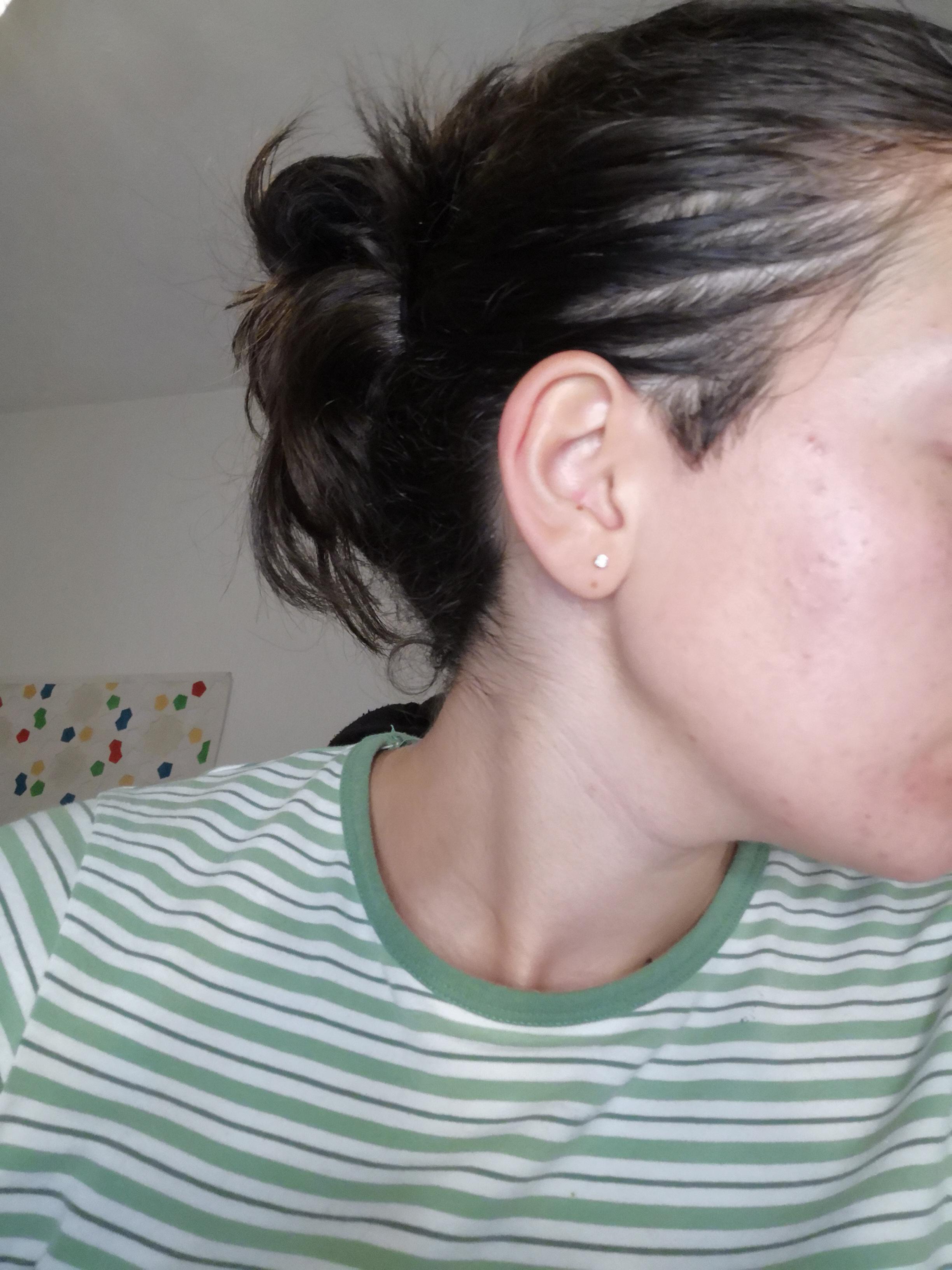 21/F need help what to do with sideburns r/HairStyleAdvice