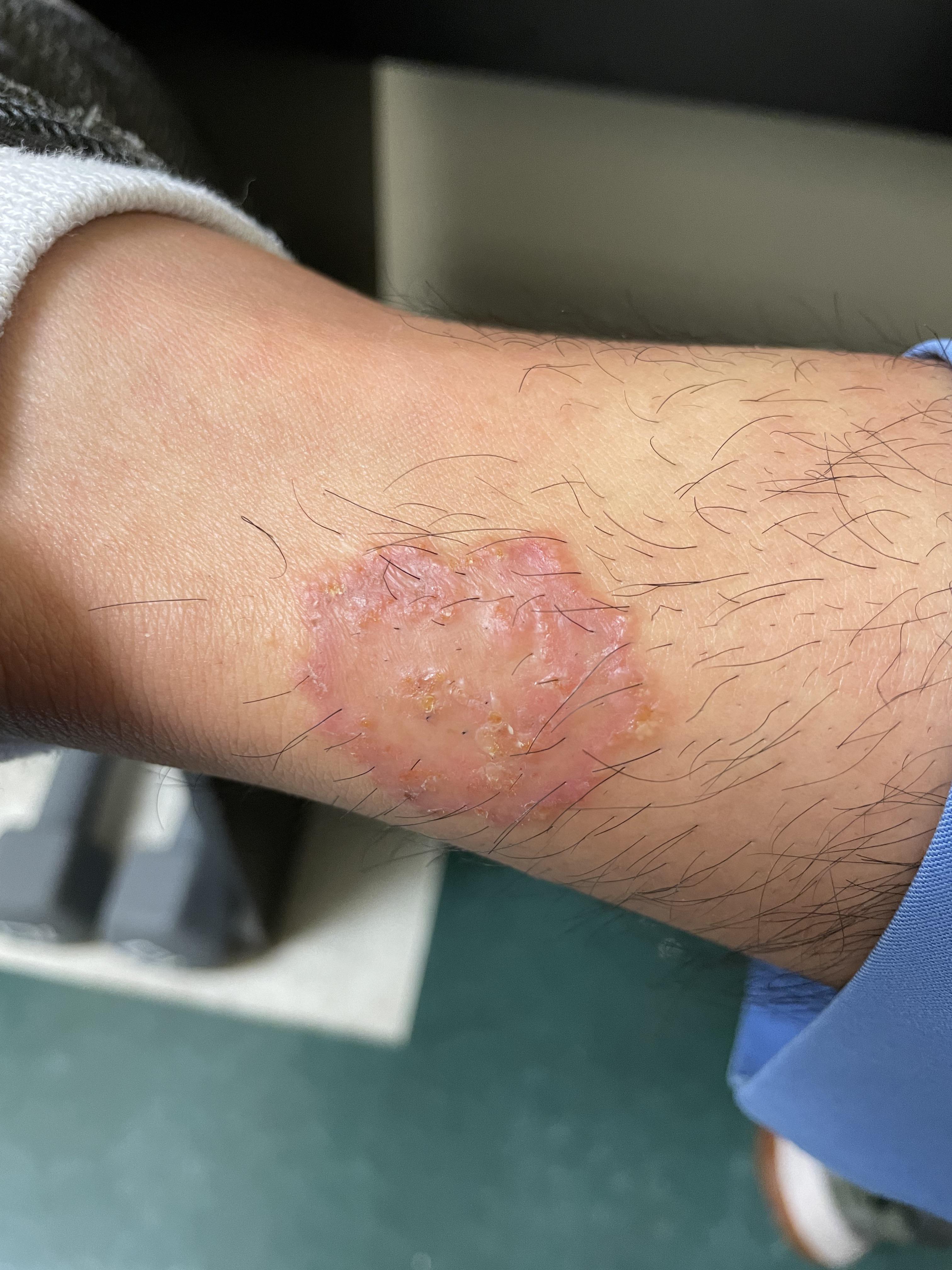 Throwback to this monster on my teammate (this was back in November