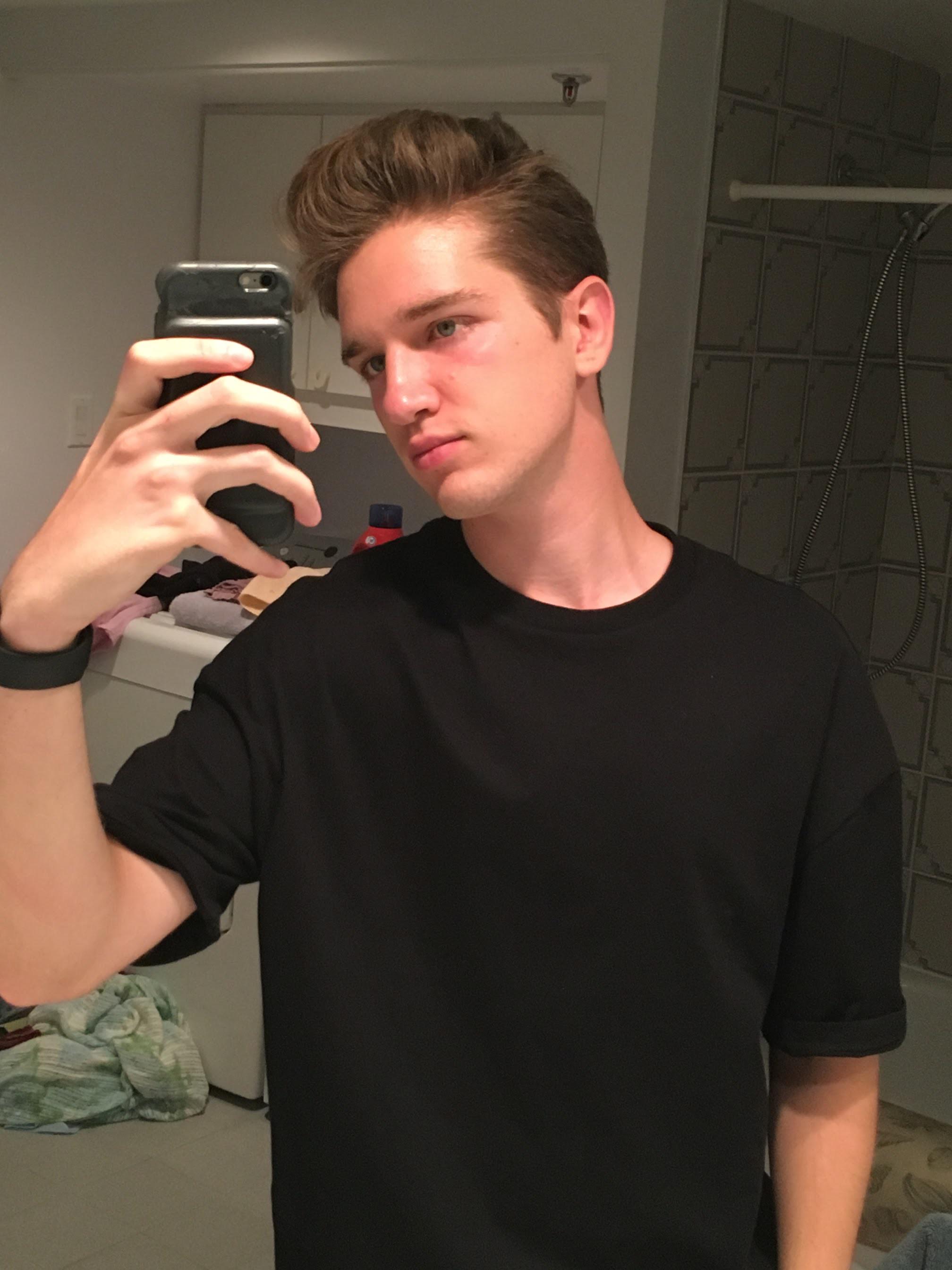 18 year old French boy r/gaybrosgonemild