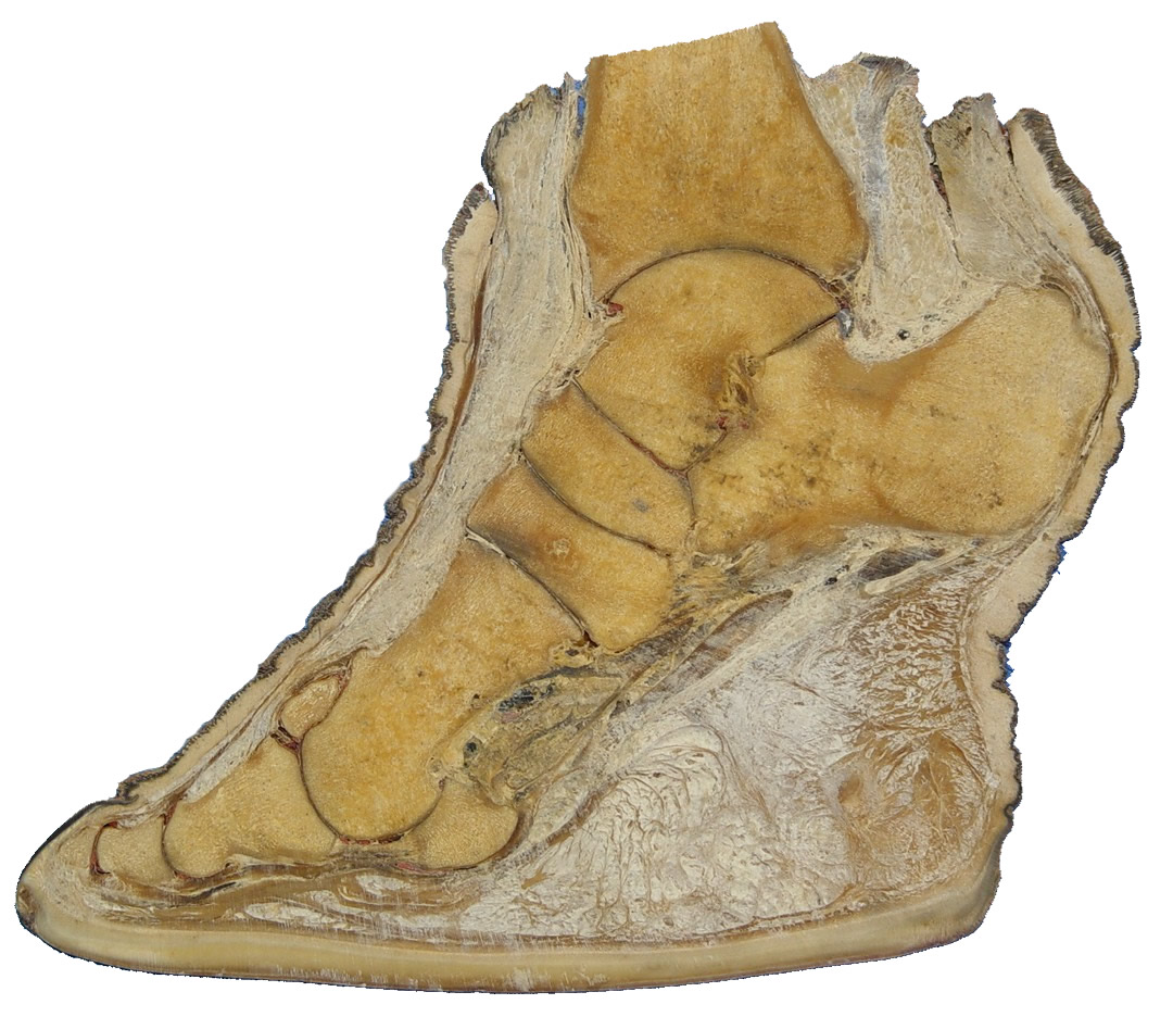 How am I just now finding out there's a human foot inside an elephant's foot? r