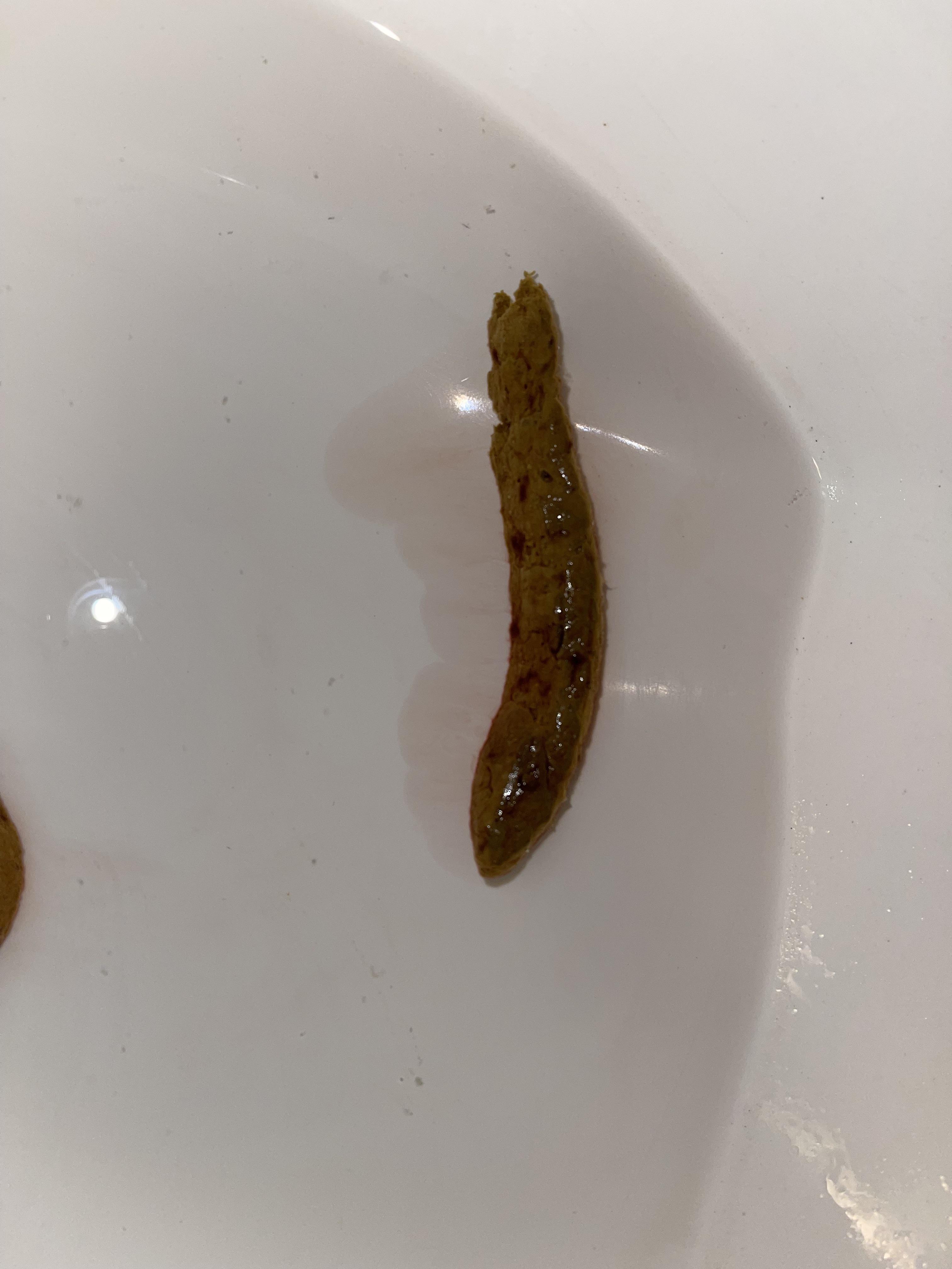 Help! is this blood or from beets? r/poop