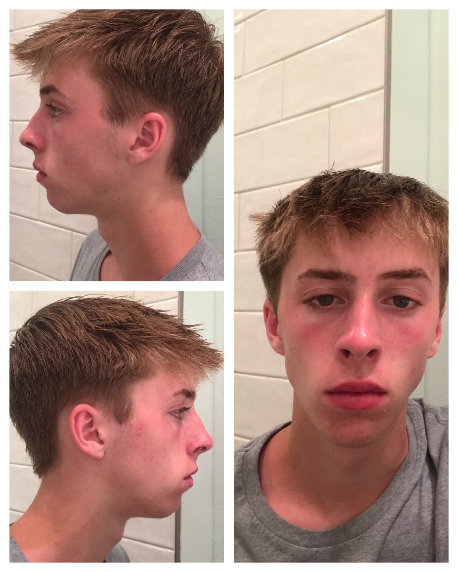 Jawzrsize Reddit Chisel Your Jaw Review / Reddit gives you the best of the in one